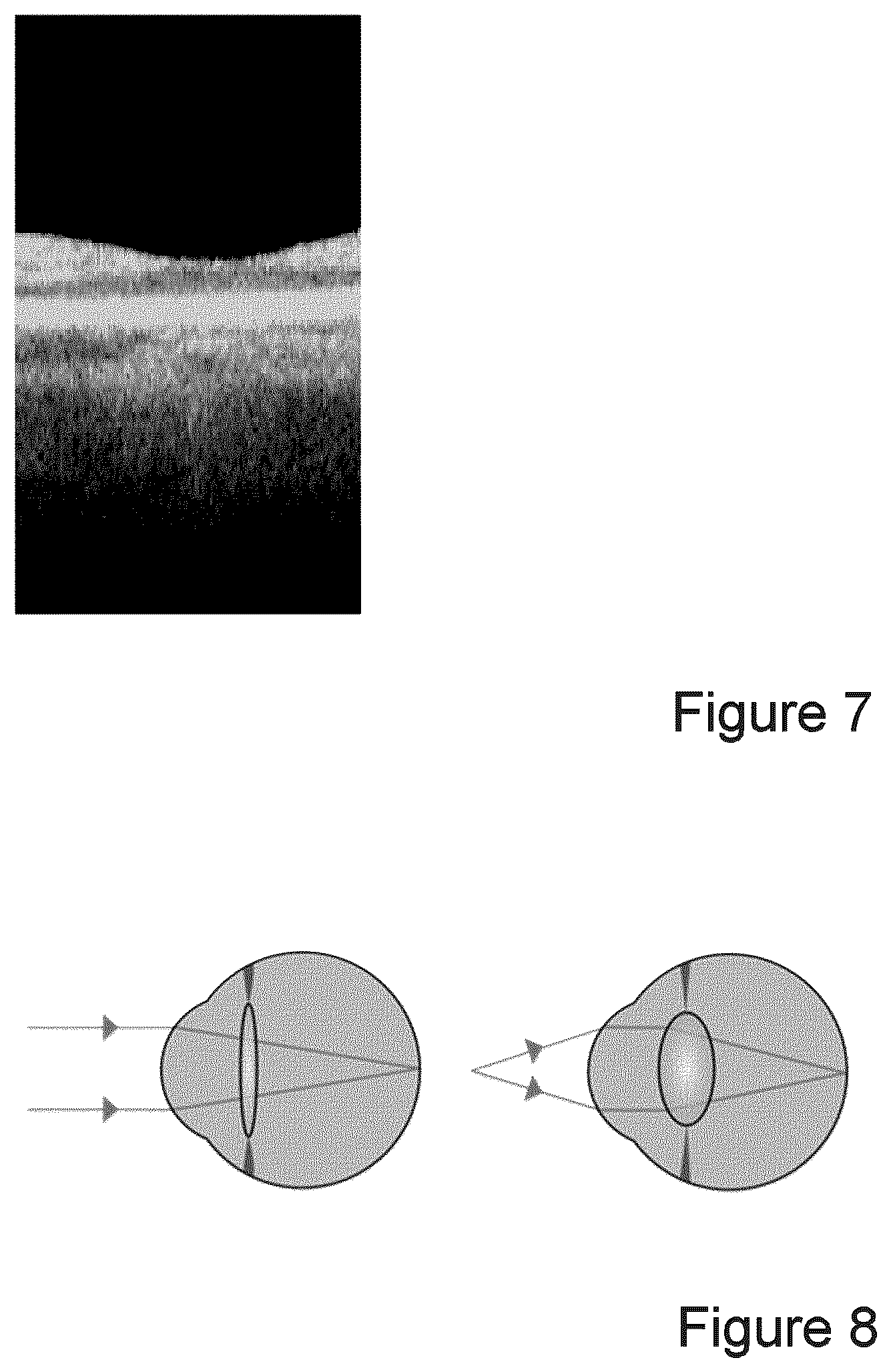 Patent US12426778 Figure 4 – Method for ascertaining physiologically correct biometric data of an eye