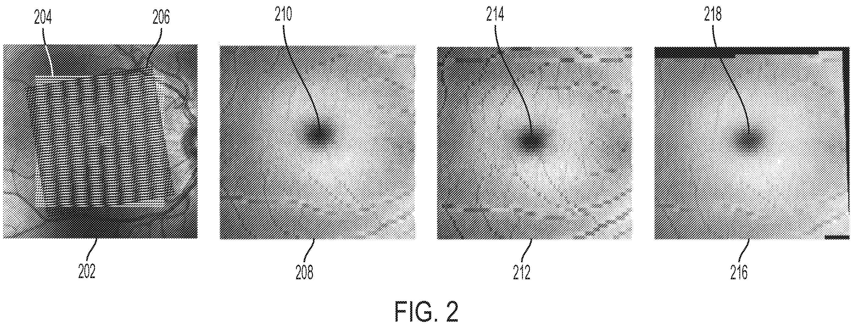 Patent US12426779 Figure 2 – Segmenting retinal OCT images with inter-B-scan and longitudinal information