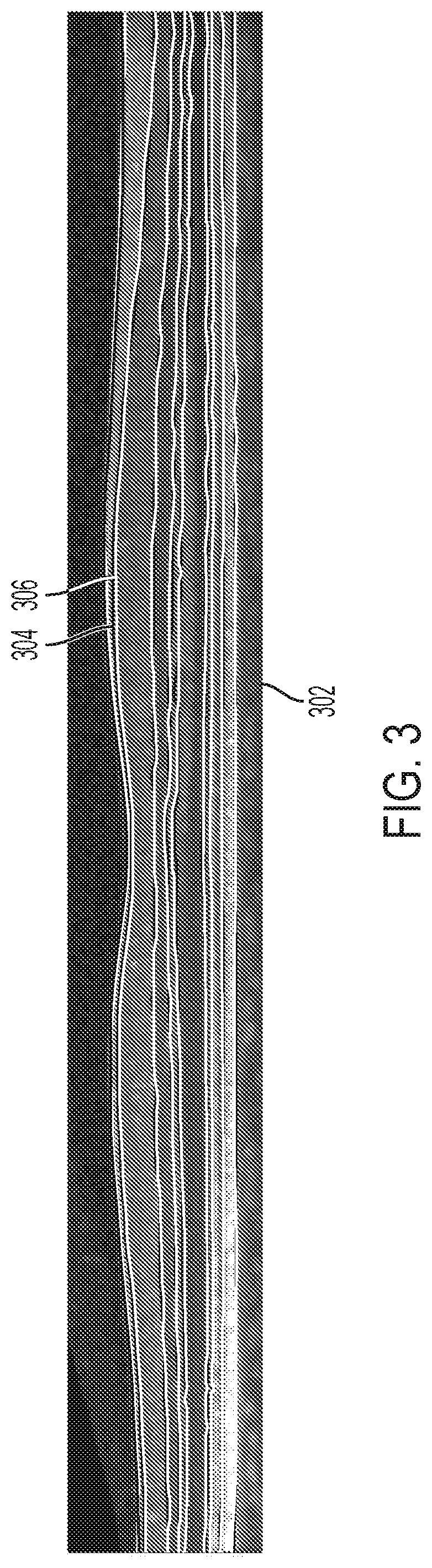 Patent US12426779 Figure 3 – Segmenting retinal OCT images with inter-B-scan and longitudinal information