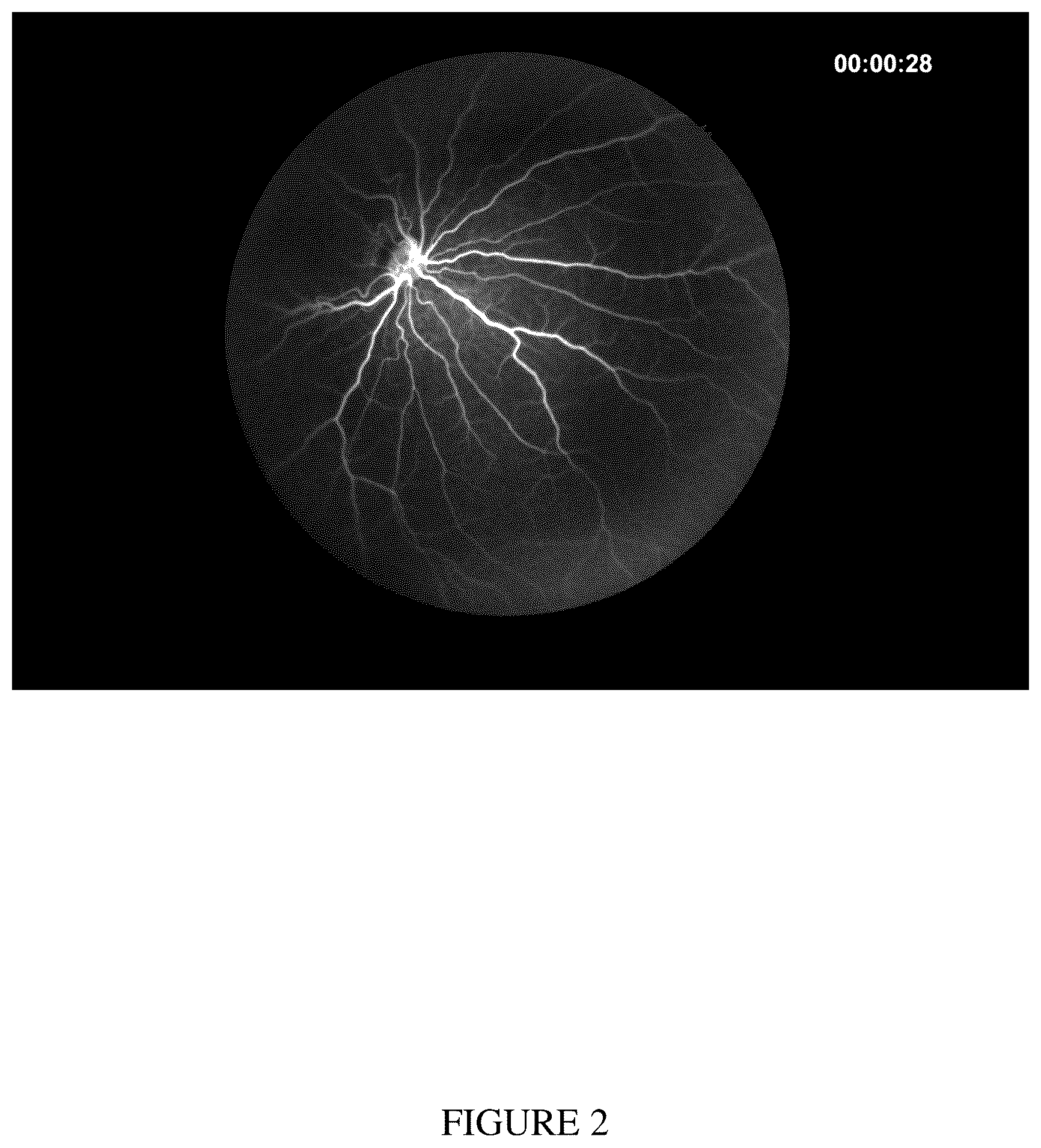 Patent US12426781 Figure 2 – Portable retinal imaging system
