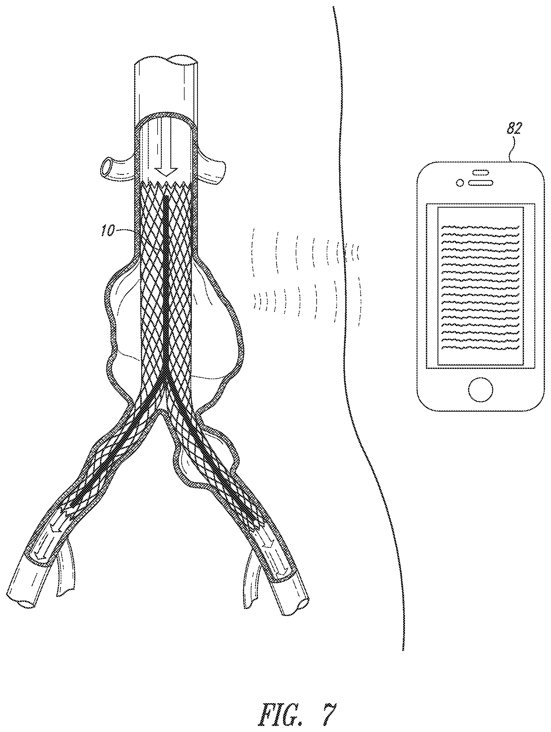 Patent US12426784 Figure 7 – Devices, systems and methods for using and monitoring medical devices