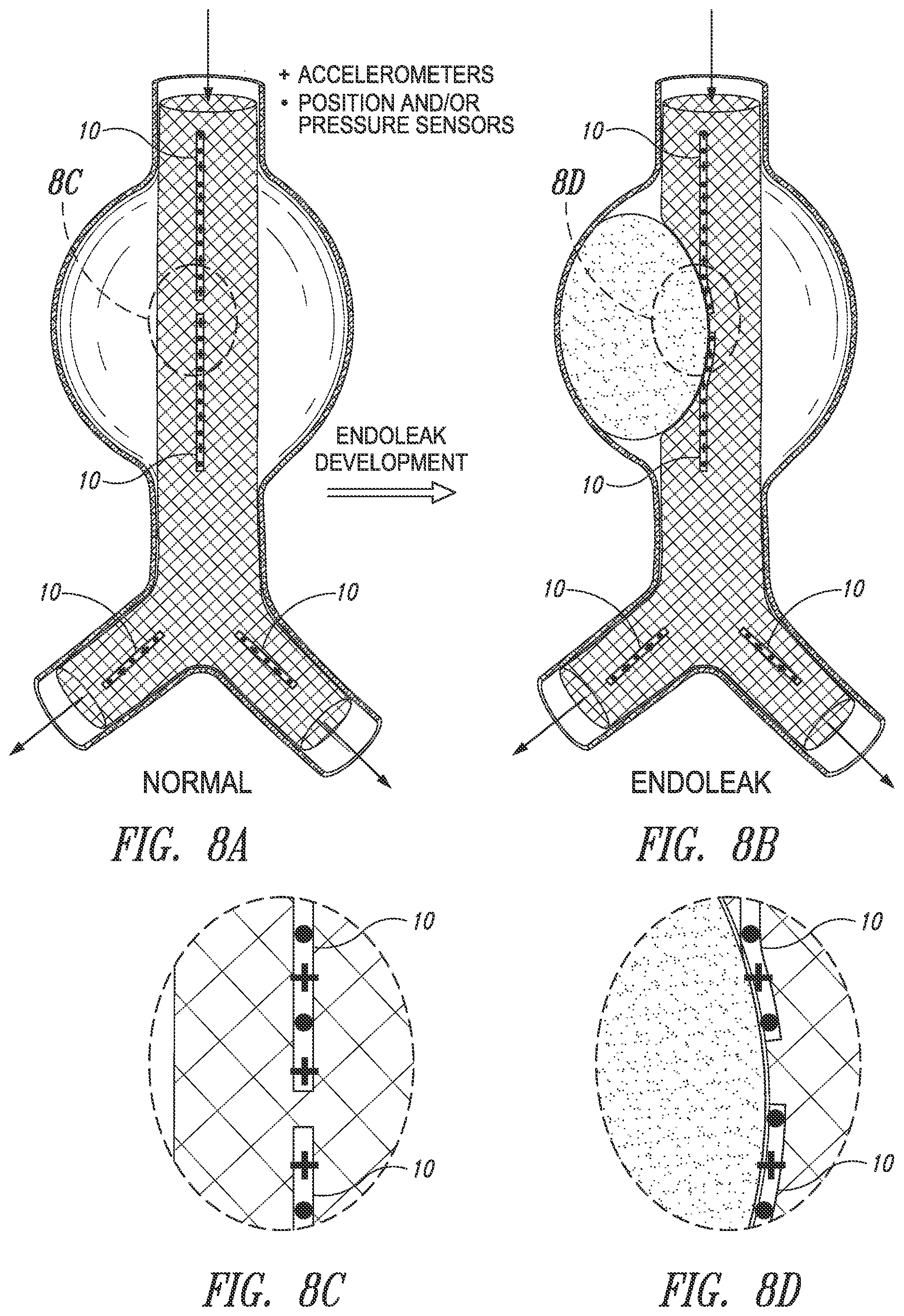 Patent US12426784 Figure 8 – Devices, systems and methods for using and monitoring medical devices