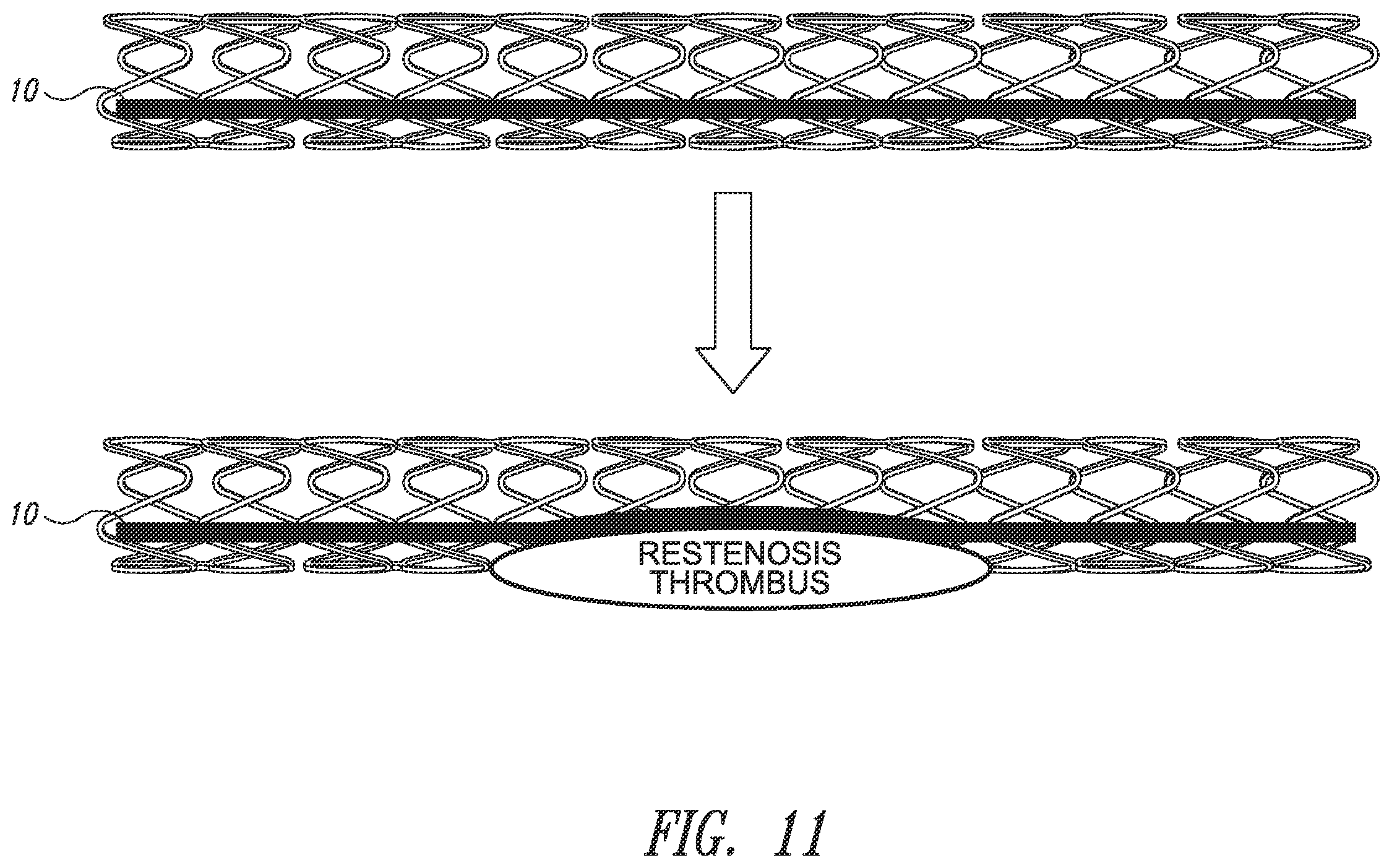 Patent US12426784 Figure 11 – Devices, systems and methods for using and monitoring medical devices