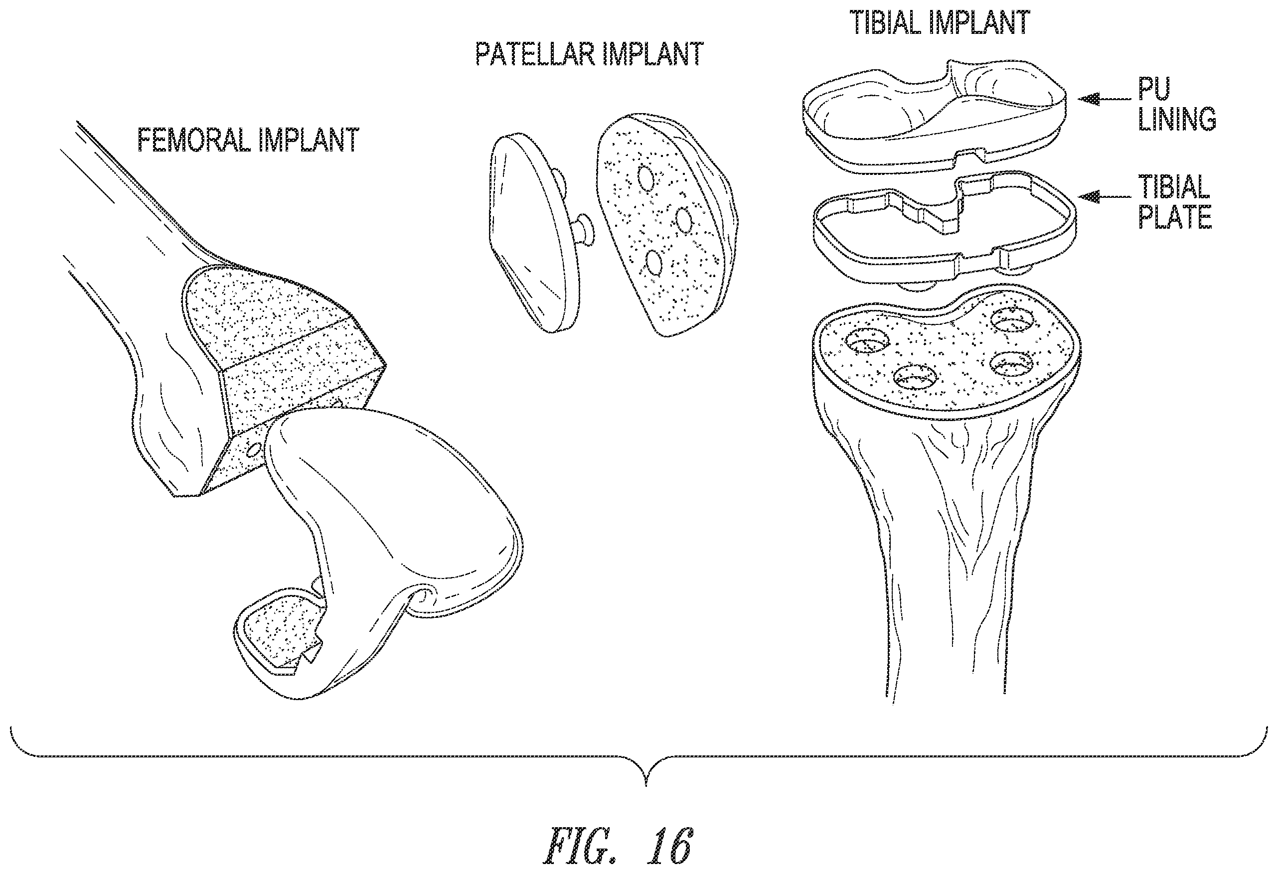 Patent US12426784 Figure 15 – Devices, systems and methods for using and monitoring medical devices