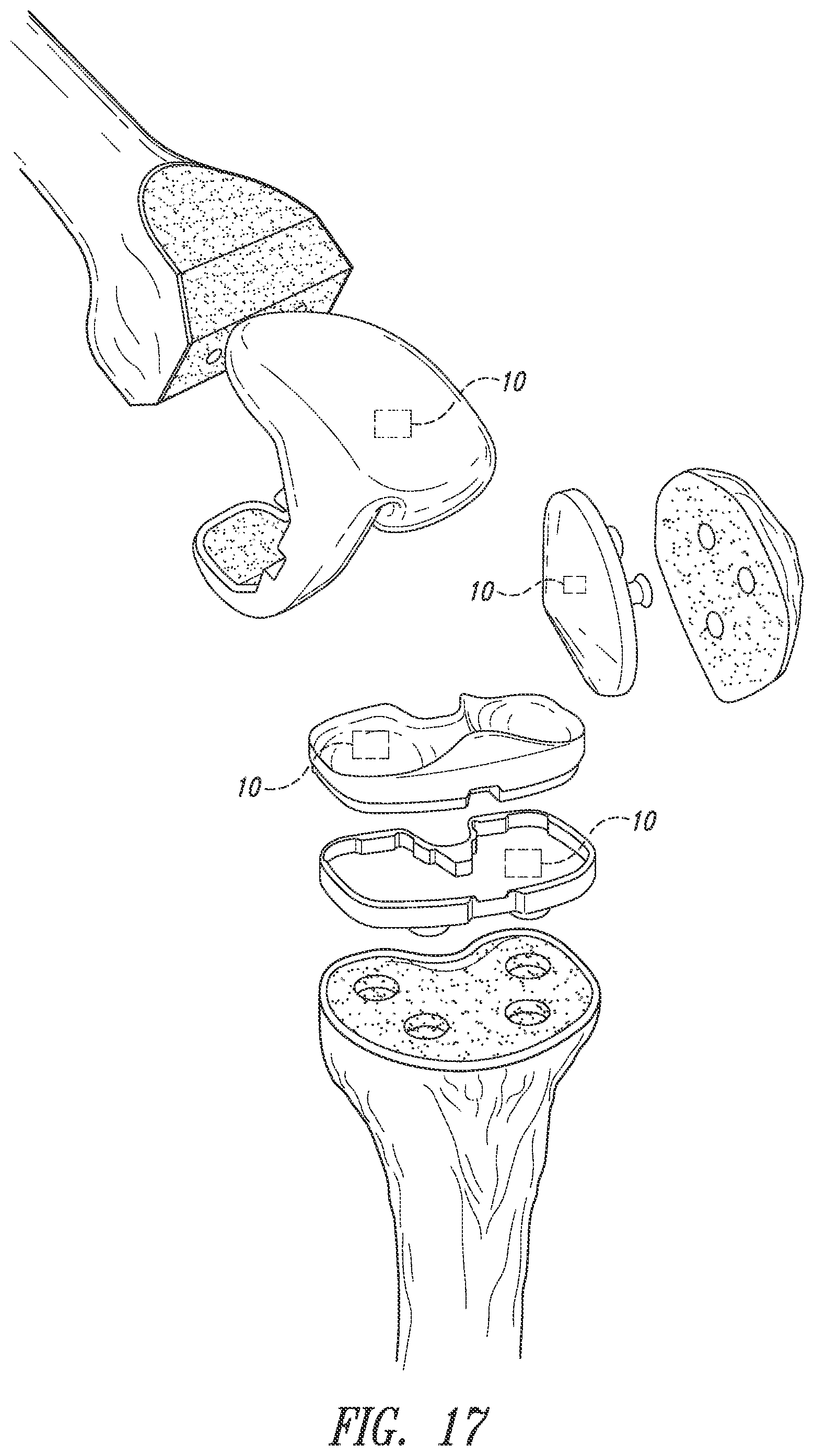 Patent US12426784 Figure 16 – Devices, systems and methods for using and monitoring medical devices