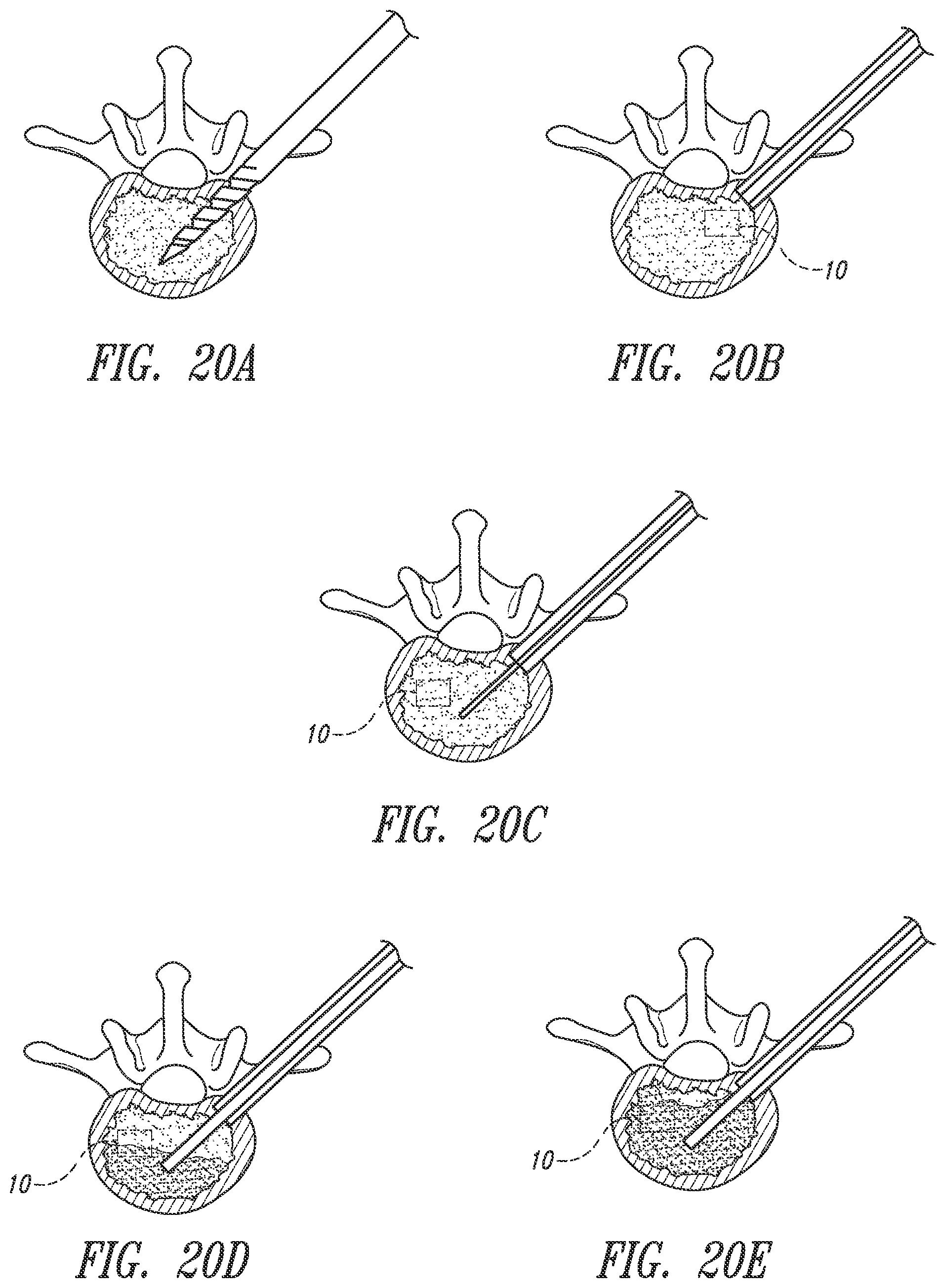 Patent US12426784 Figure 18 – Devices, systems and methods for using and monitoring medical devices
