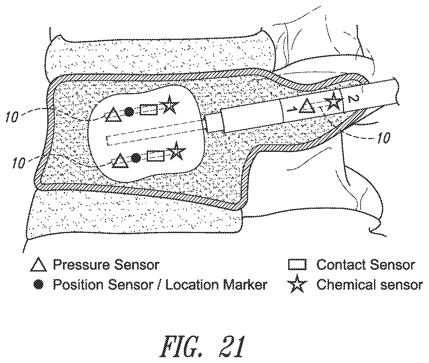 Patent US12426784 Figure 19 – Devices, systems and methods for using and monitoring medical devices