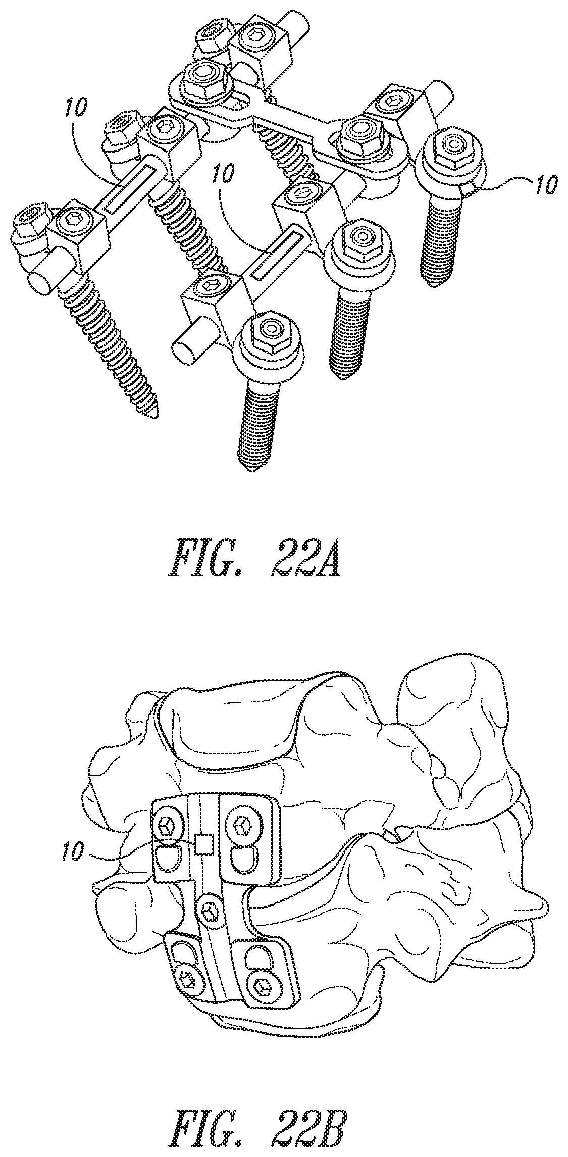 Patent US12426784 Figure 20 – Devices, systems and methods for using and monitoring medical devices