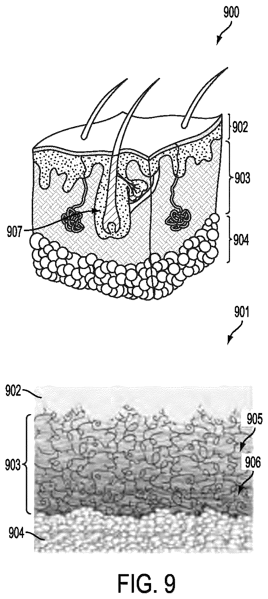 Patent US12426788 Figure 14 – Active remote sensing of atmospheric gases or smoke using a time-of-flight sensor