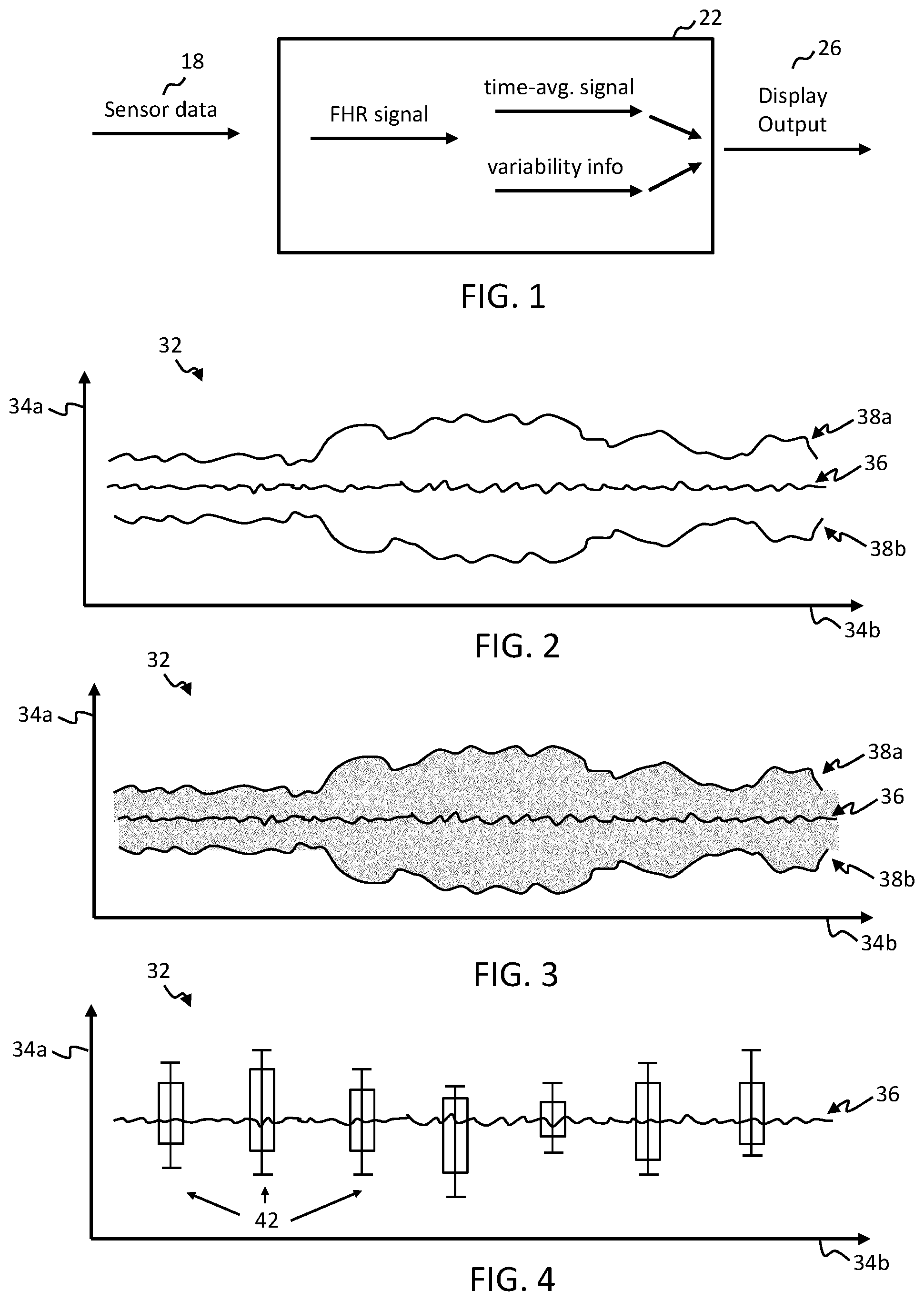 Patent US12426792 Figure 1 – Processing unit and method for use in fetal monitoring