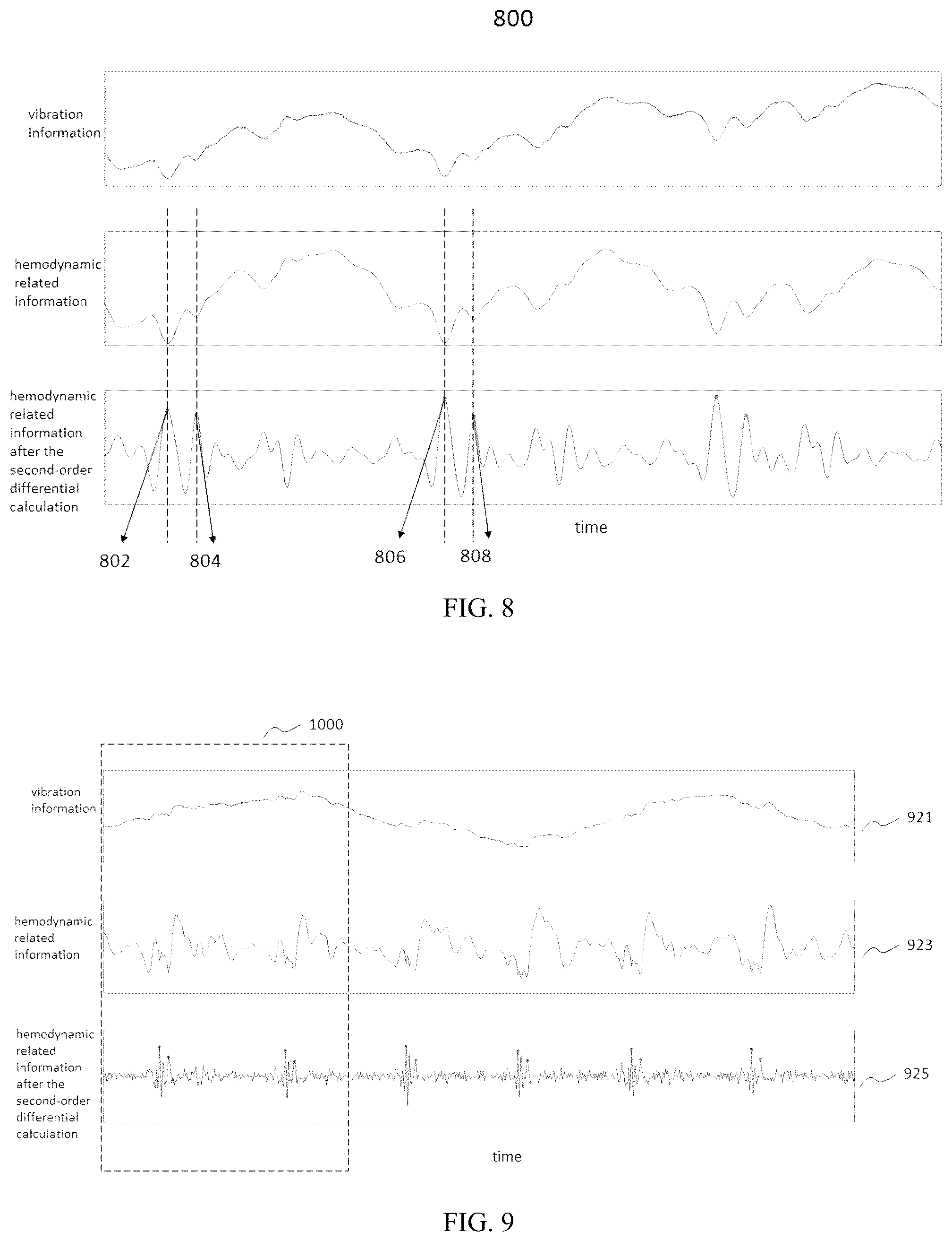 Patent US12426794 Figure 5 – Pulse wave conduction parameter measuring method and pulse wave conduction parameter processing device