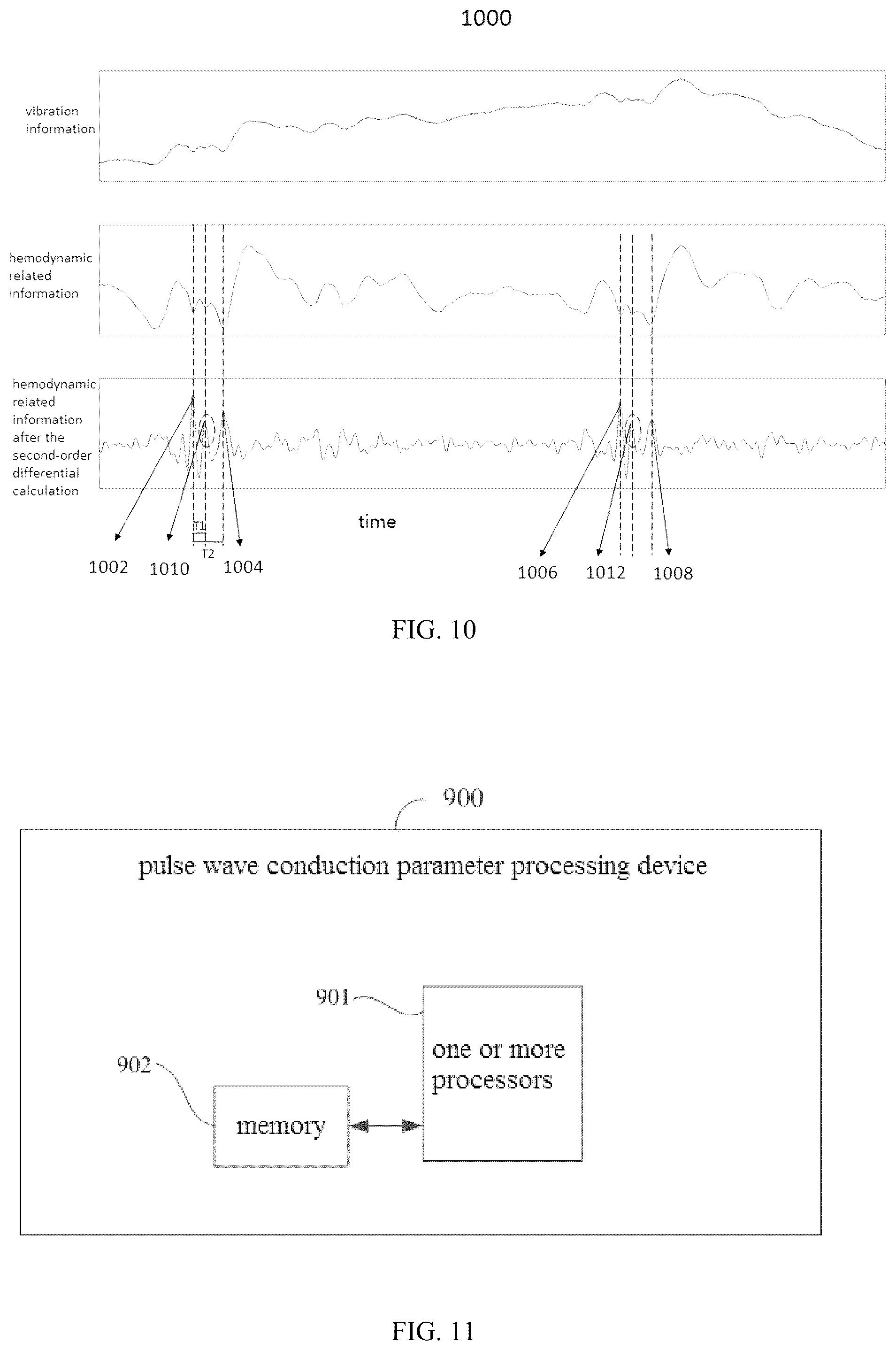 Patent US12426794 Figure 6 – Pulse wave conduction parameter measuring method and pulse wave conduction parameter processing device
