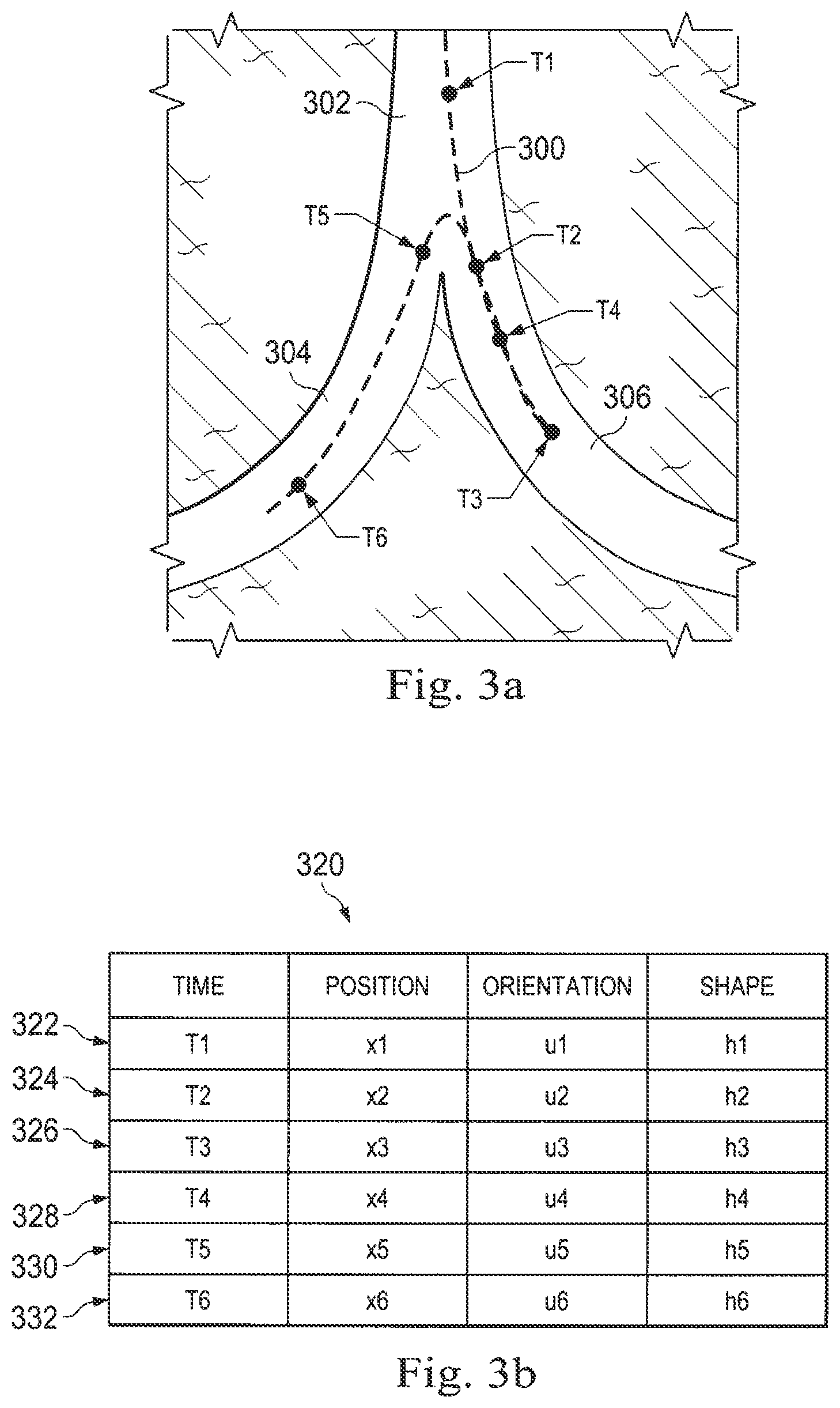 Patent US12426798 Figure 3 – Systems and methods for navigation based on ordered sensor records