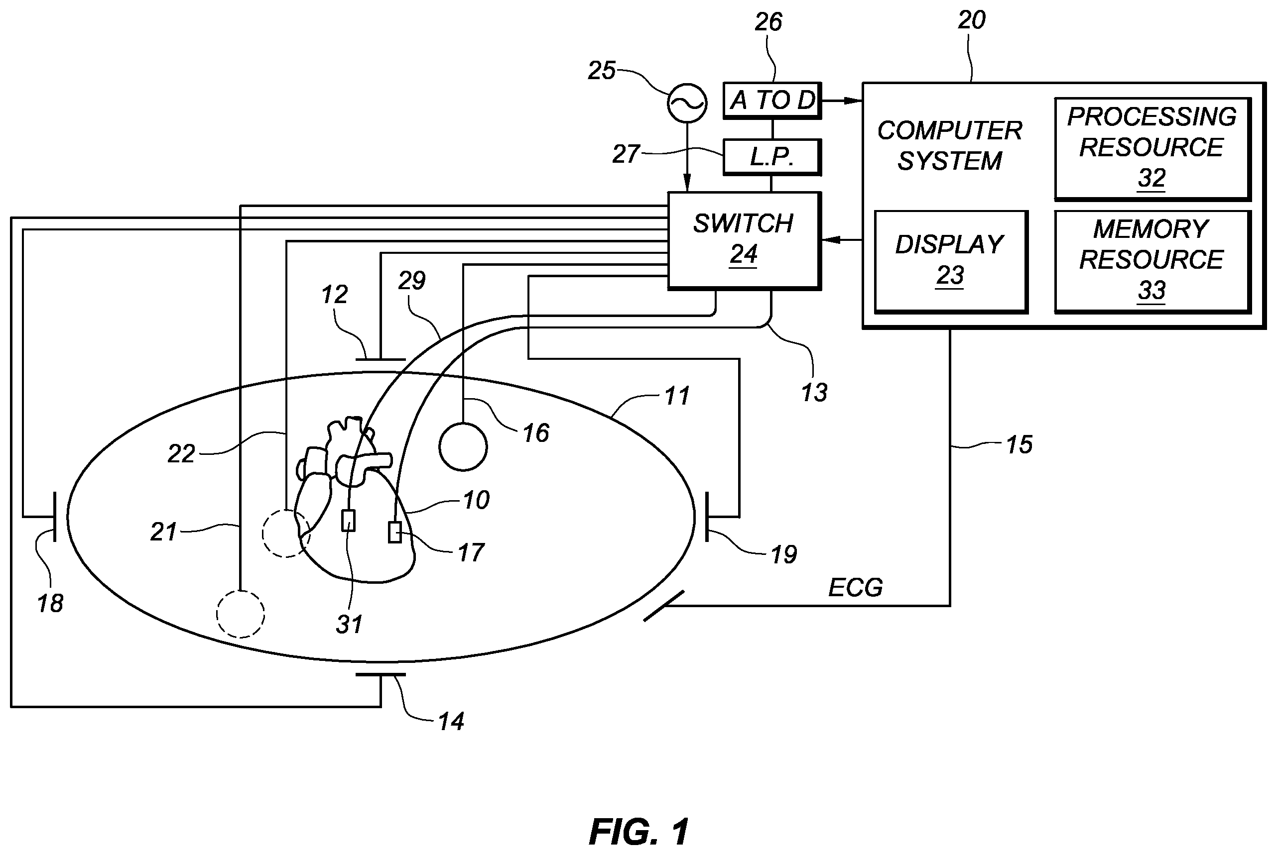 Patent US12426799 Figure 1 – Determination of catheter shape