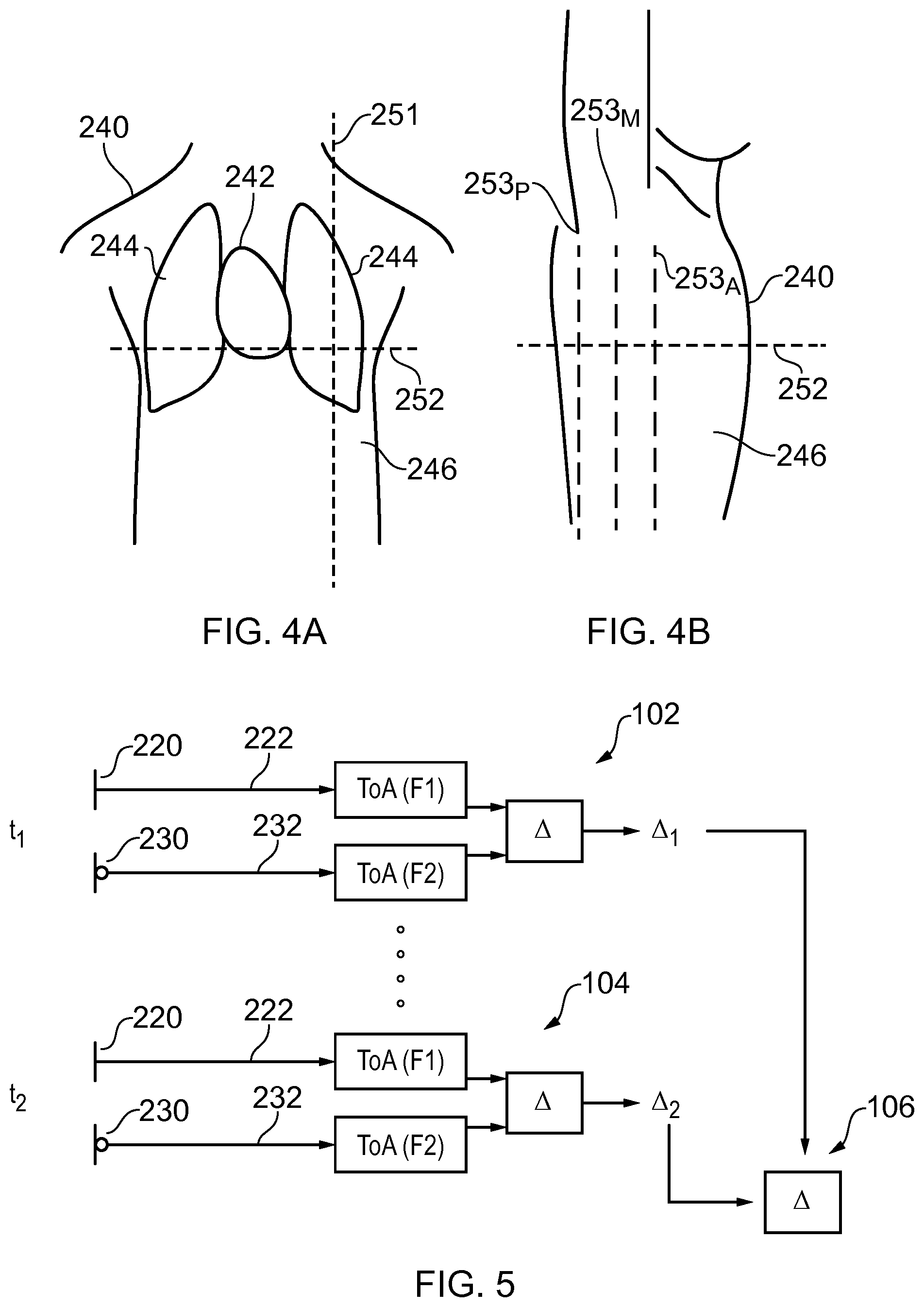 Patent US12426800 Figure 2 – Detecting increasing fluid in a lung of a subject