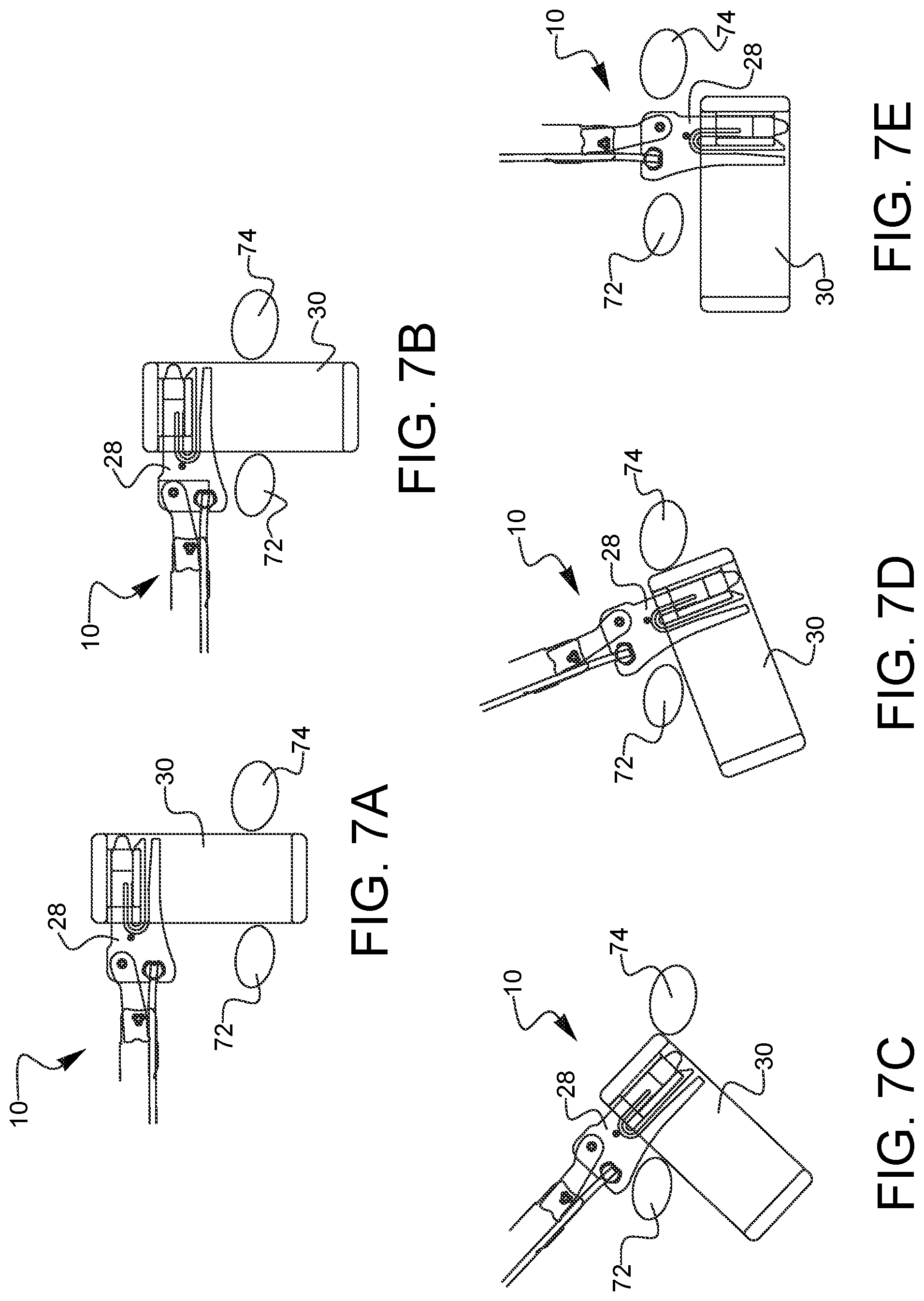 Patent US12426802 Figure 8 – Surgical sizer sound