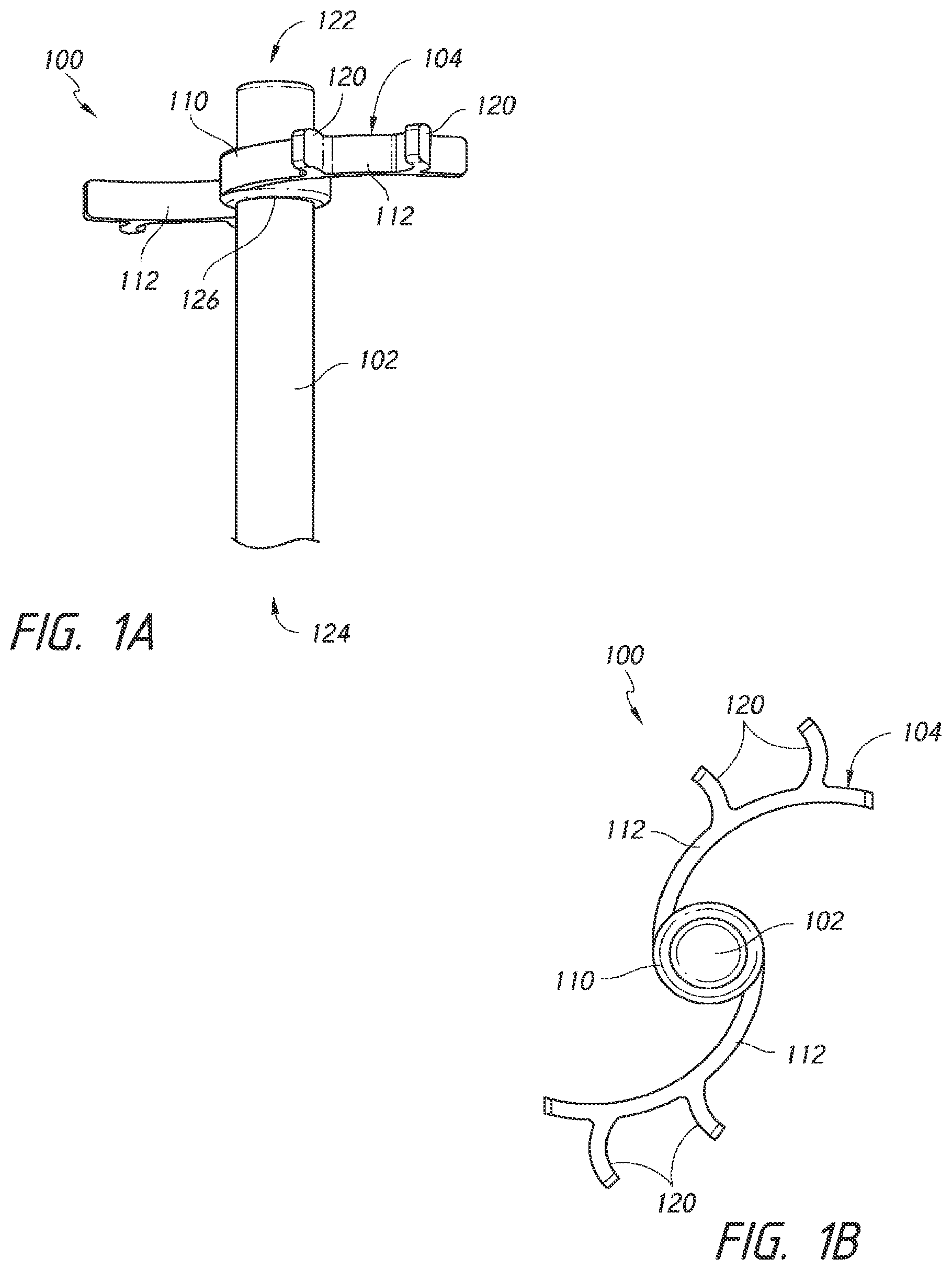 Patent US12426803 Figure 1 – Endoluminal sizing device