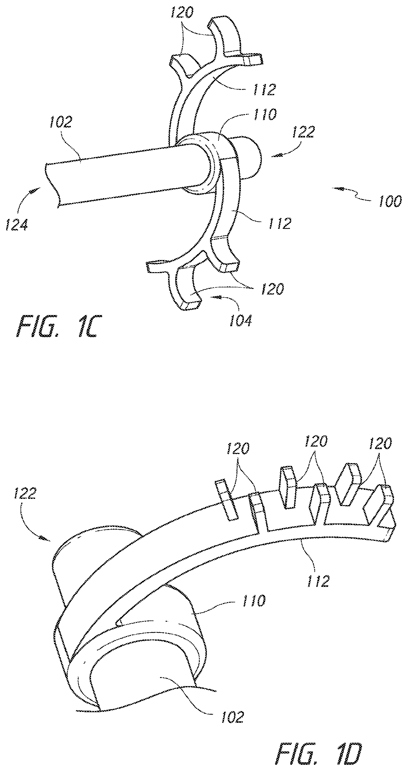 Patent US12426803 Figure 2 – Endoluminal sizing device