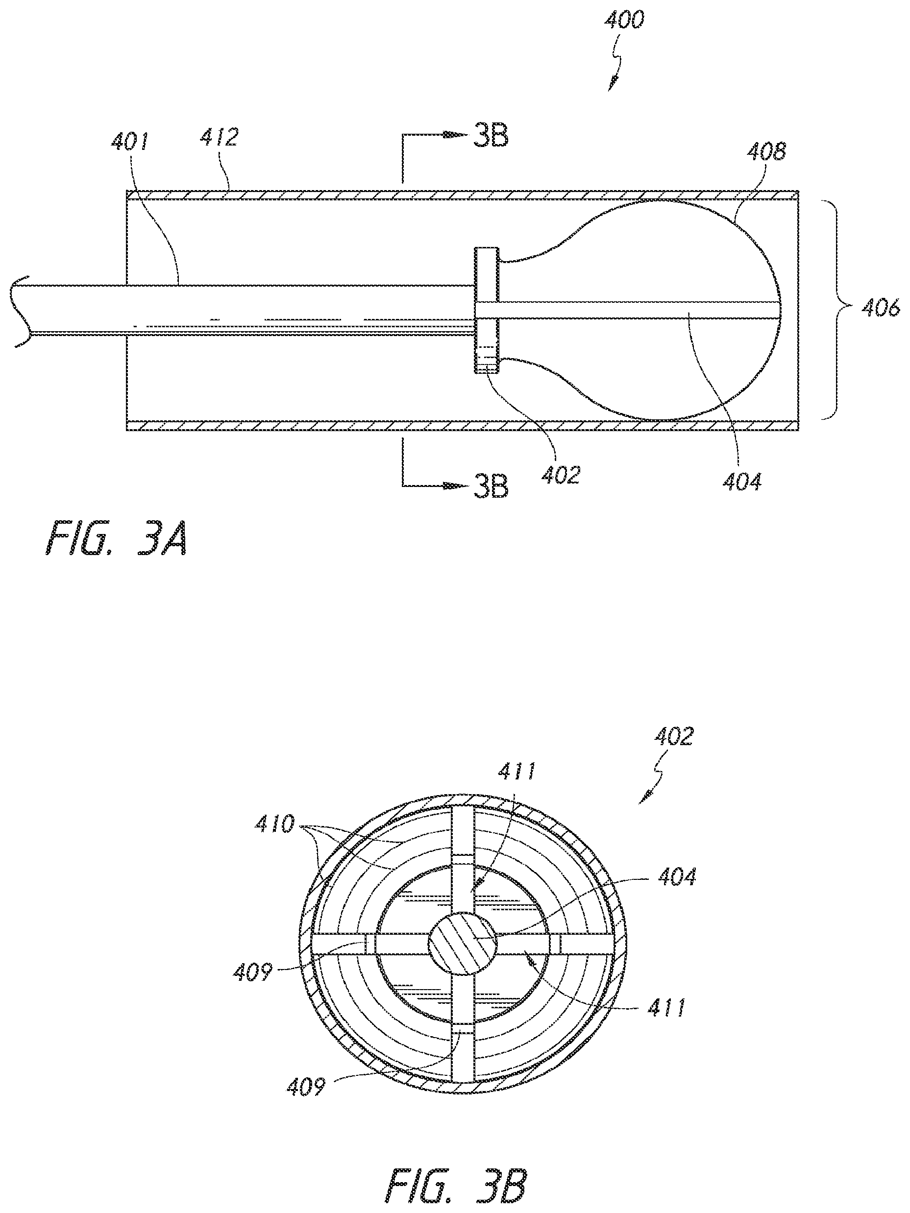 Patent US12426803 Figure 4 – Endoluminal sizing device