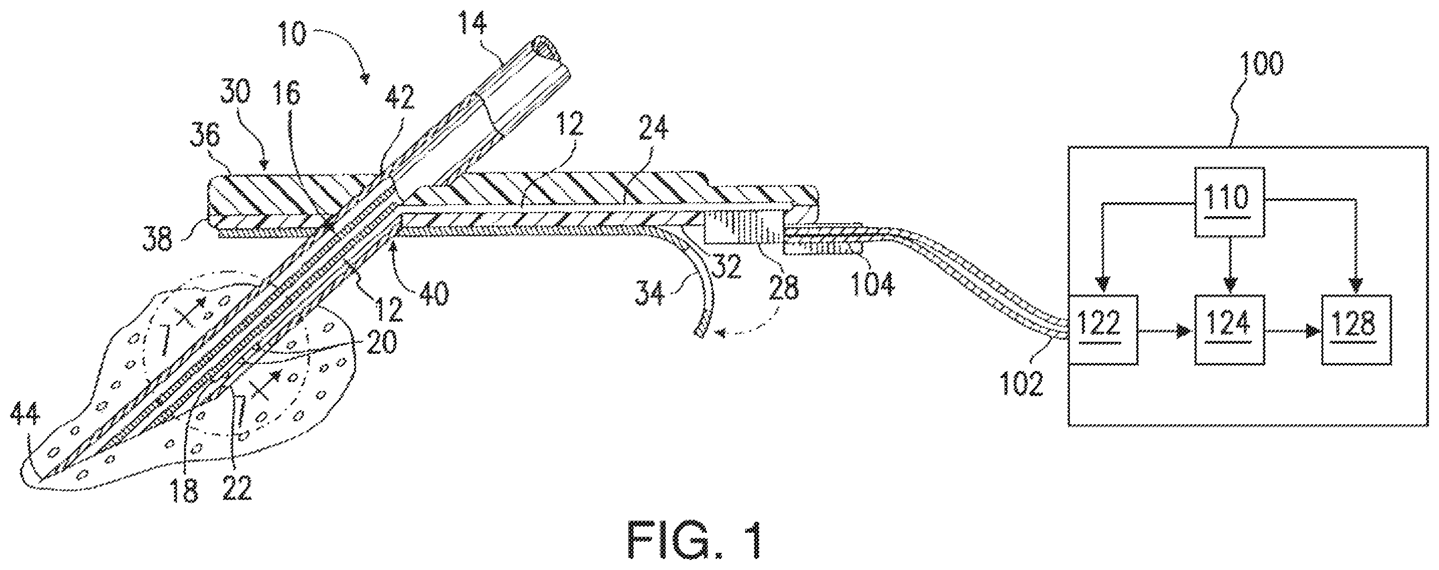 Patent US12426810 Figure 1 – Methods, systems, and devices for sensor fusion