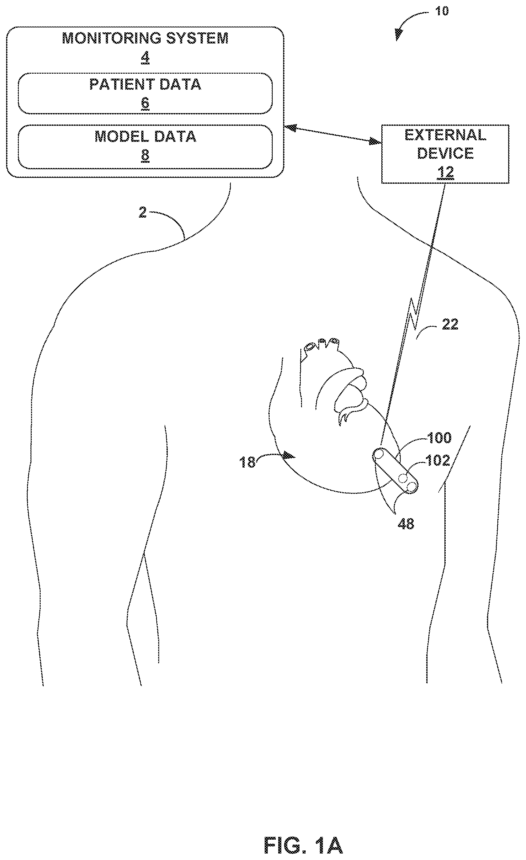 Patent US12426811 Figure 1 – Detection of changes in patient health based on glucose data