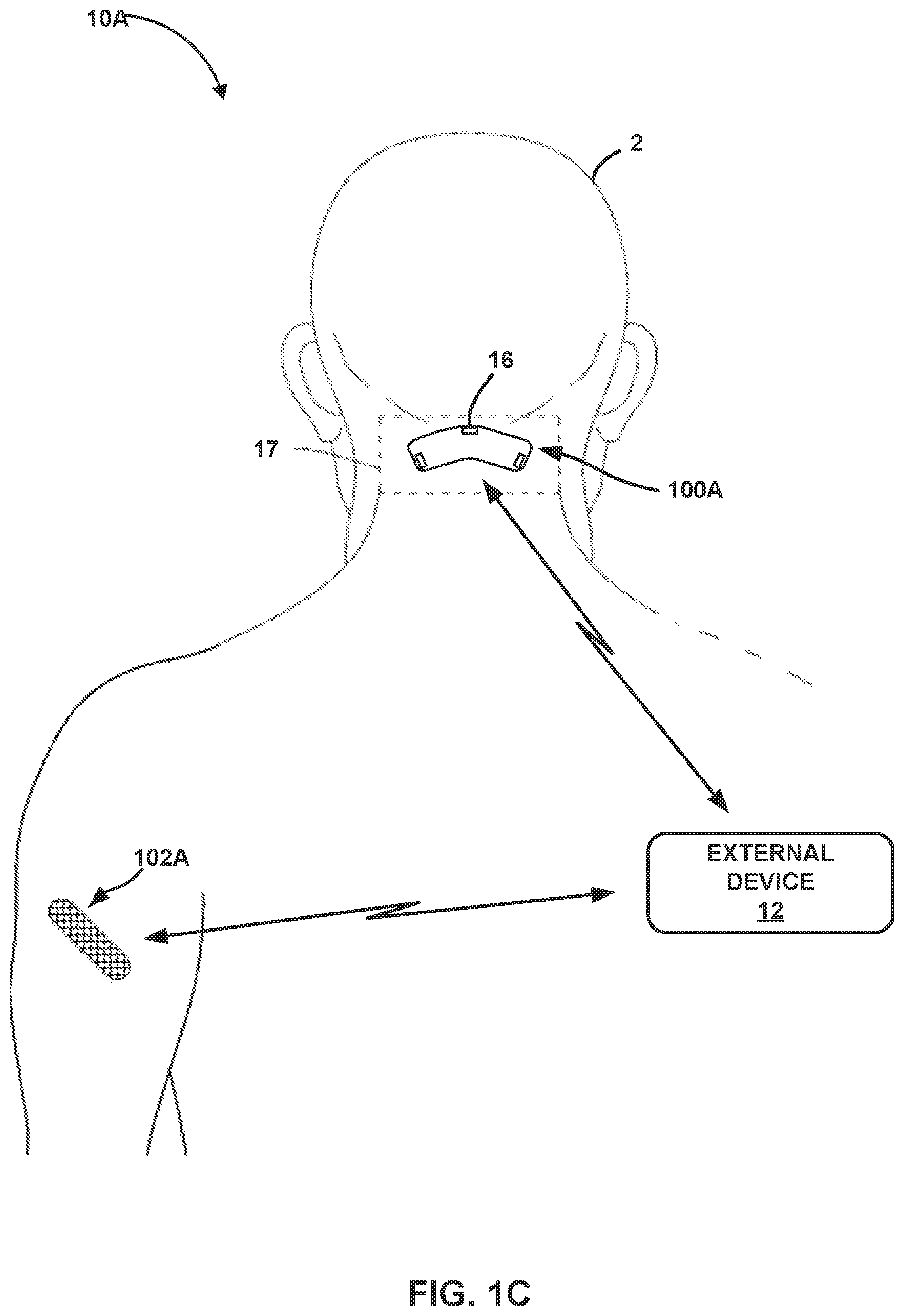 Patent US12426811 Figure 3 – Detection of changes in patient health based on glucose data