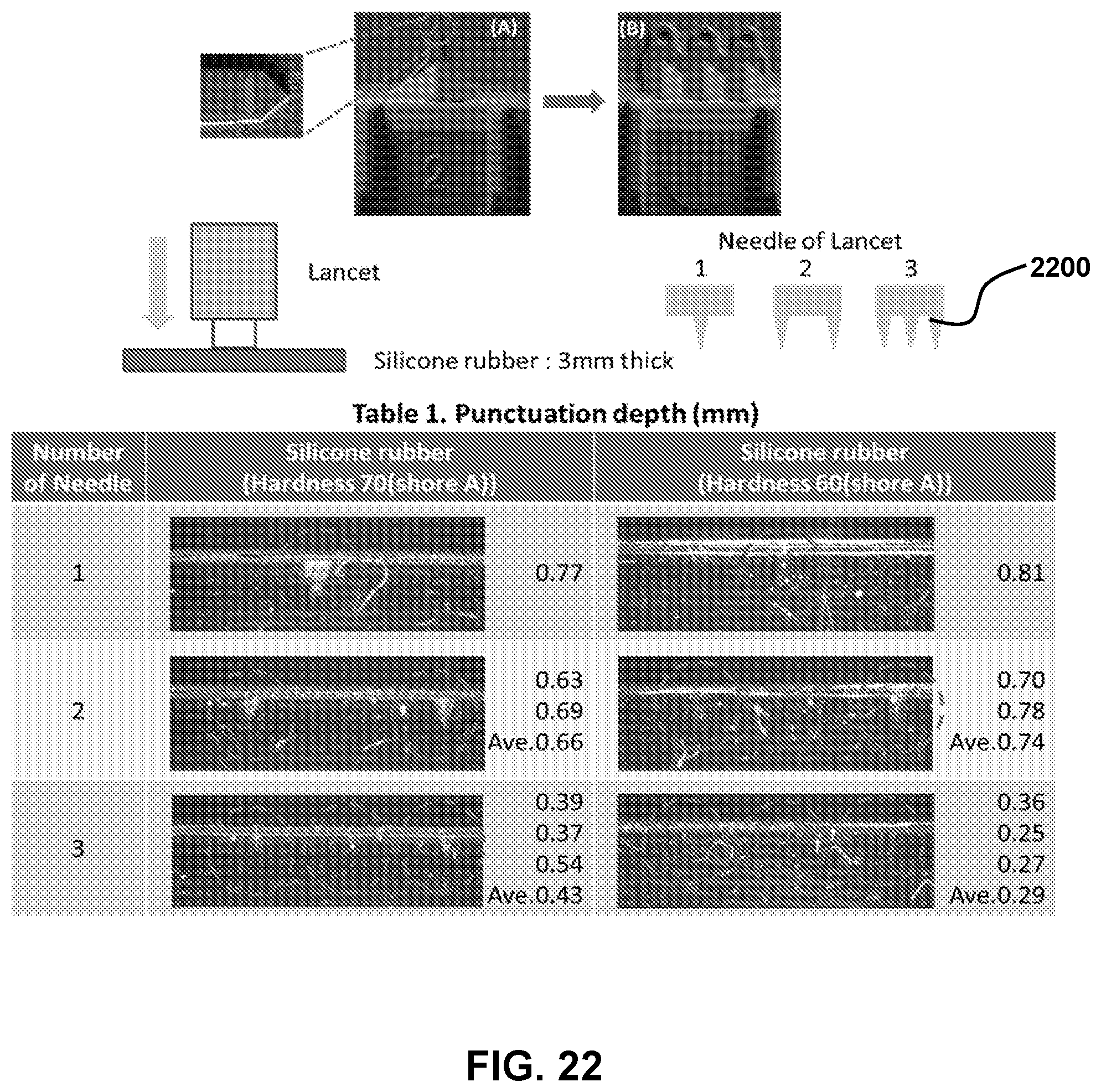 Patent US12426815 Figure 19 – Integrated device for self-collecting and automated pre-processing of biological fluids