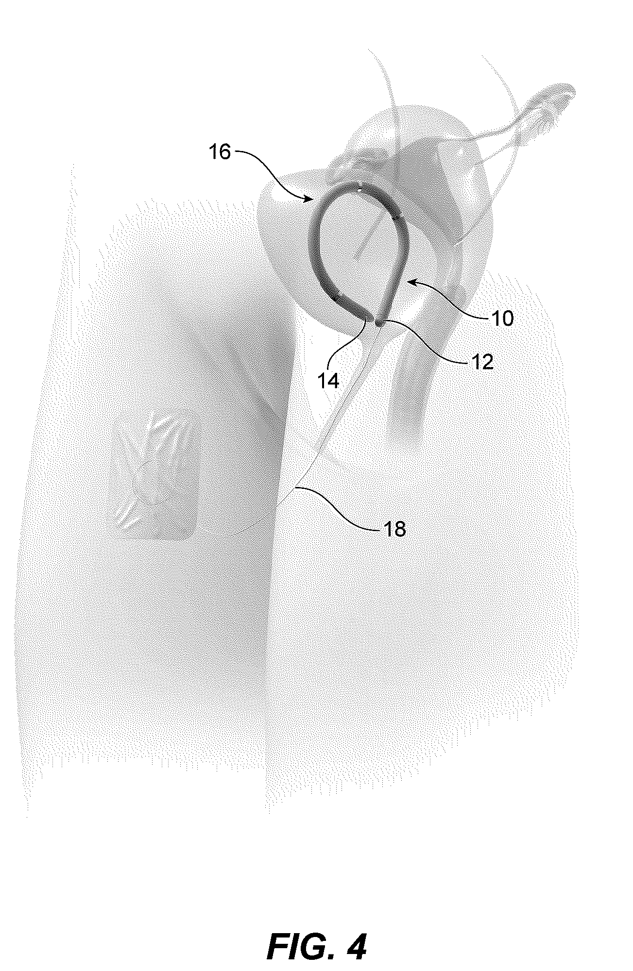 Patent US12426818 Figure 3 – Packaging assembly and method of preparing sensing device for insertion into a body cavity to preserve sterility