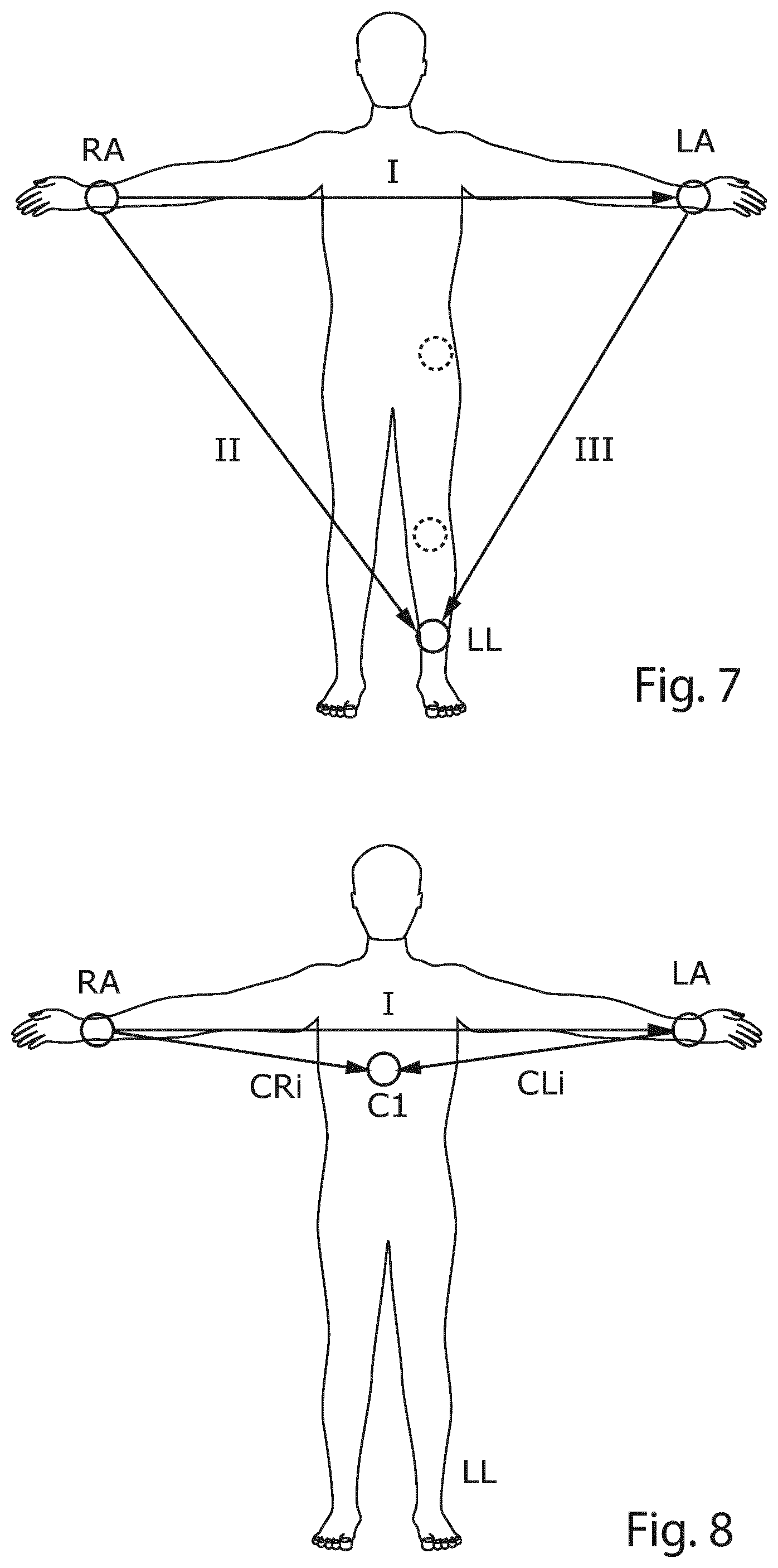 Patent US12426822 Figure 4 – Method and a system for producing a standard 12-lead ECG