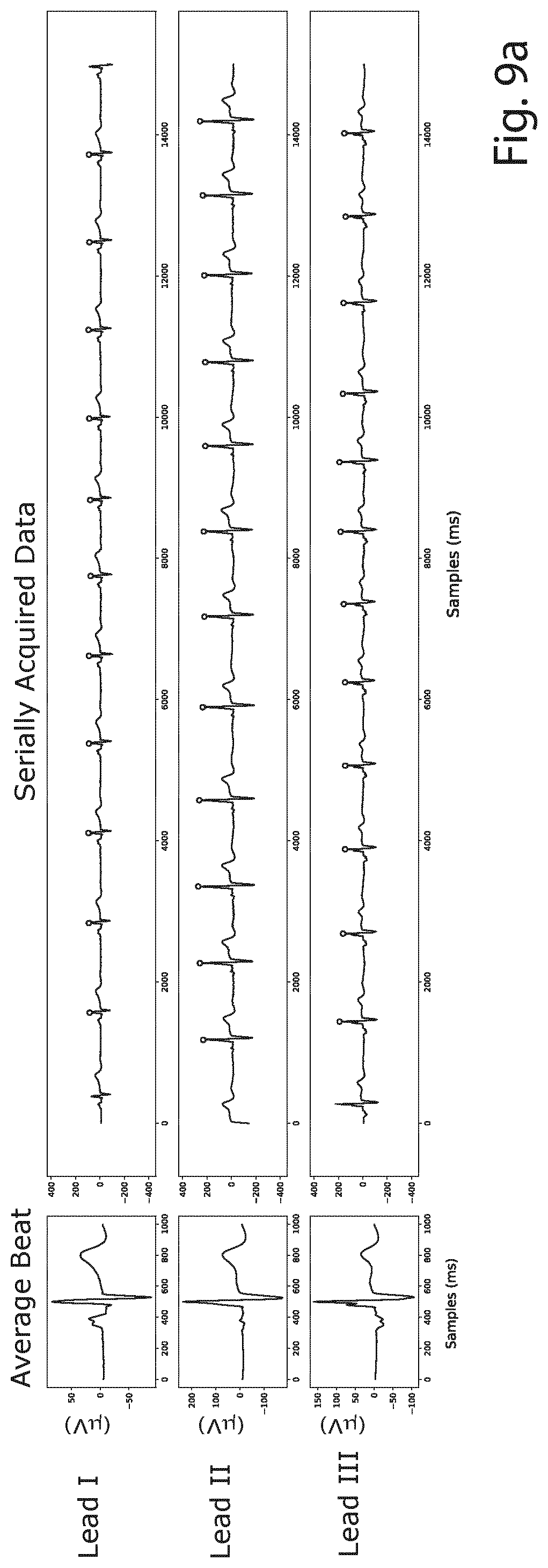Patent US12426822 Figure 5 – Method and a system for producing a standard 12-lead ECG