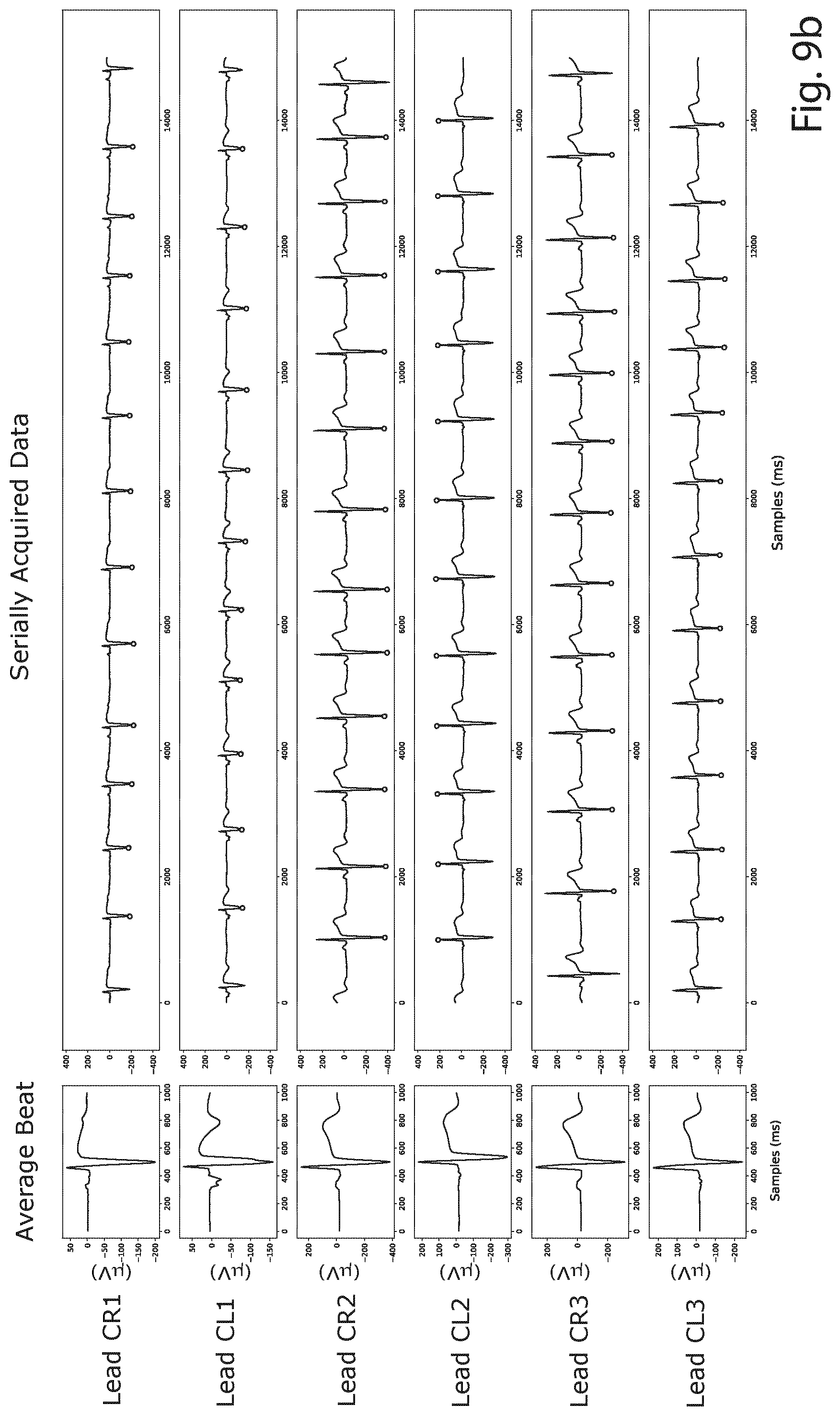 Patent US12426822 Figure 6 – Method and a system for producing a standard 12-lead ECG