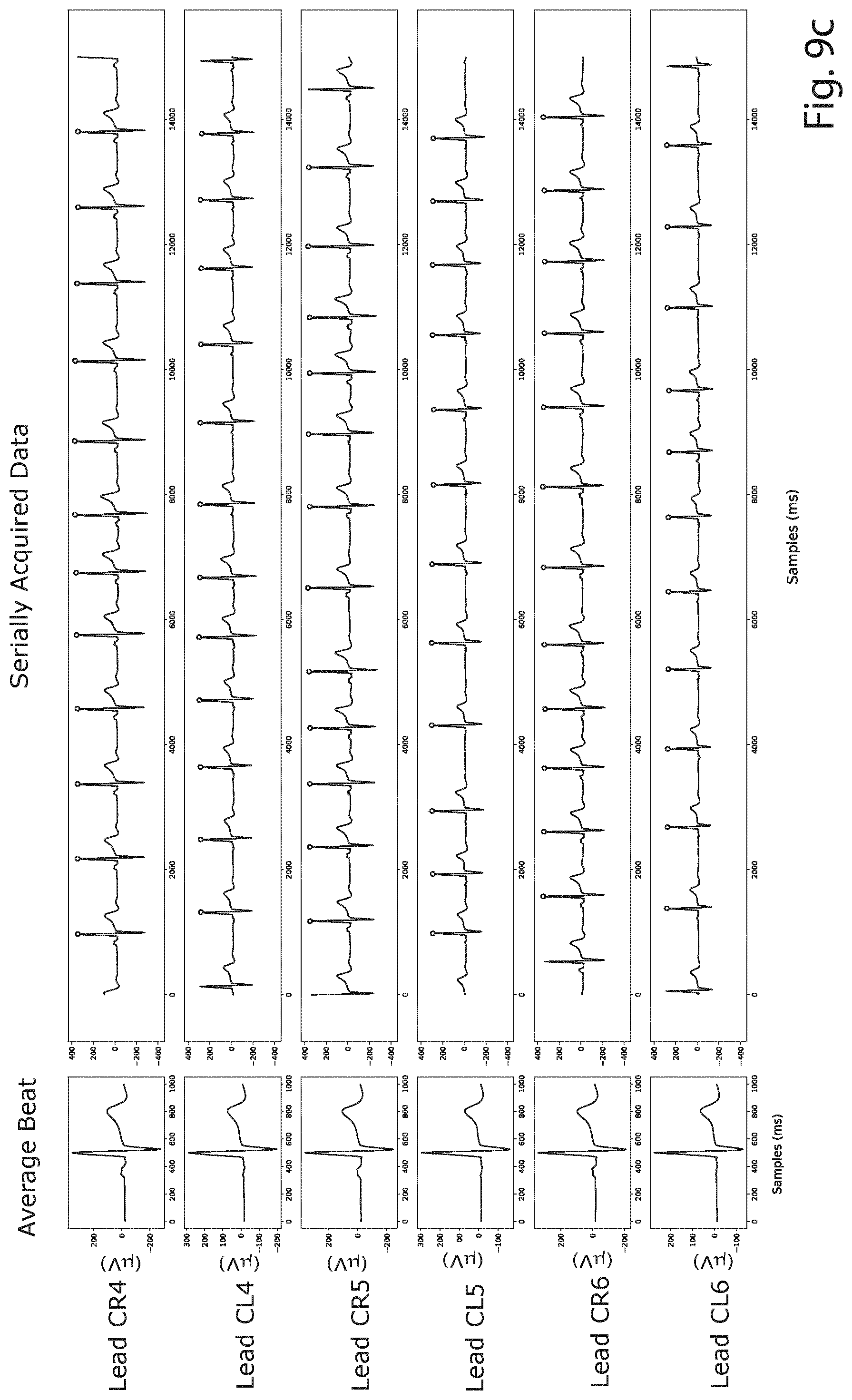 Patent US12426822 Figure 7 – Method and a system for producing a standard 12-lead ECG