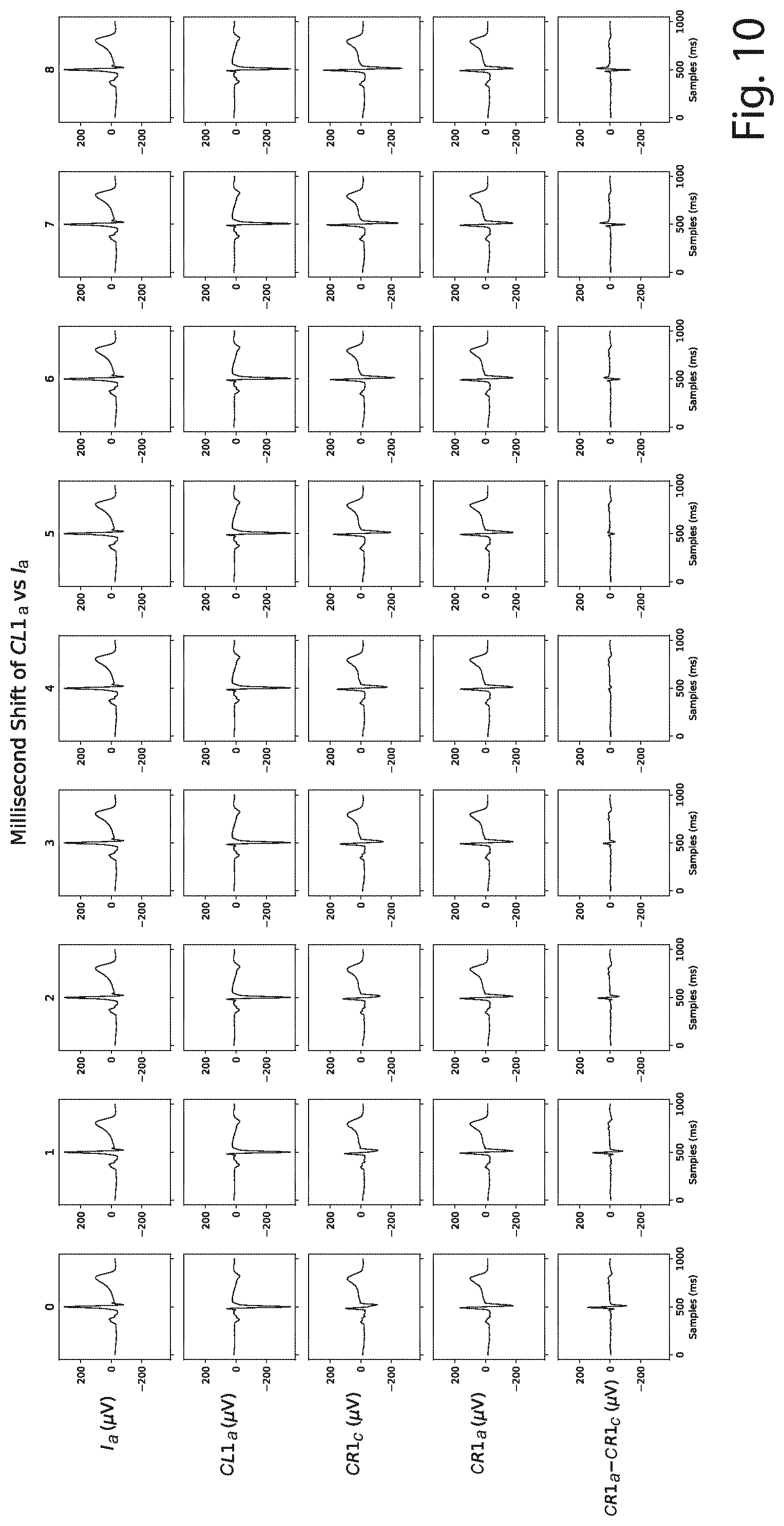 Patent US12426822 Figure 8 – Method and a system for producing a standard 12-lead ECG