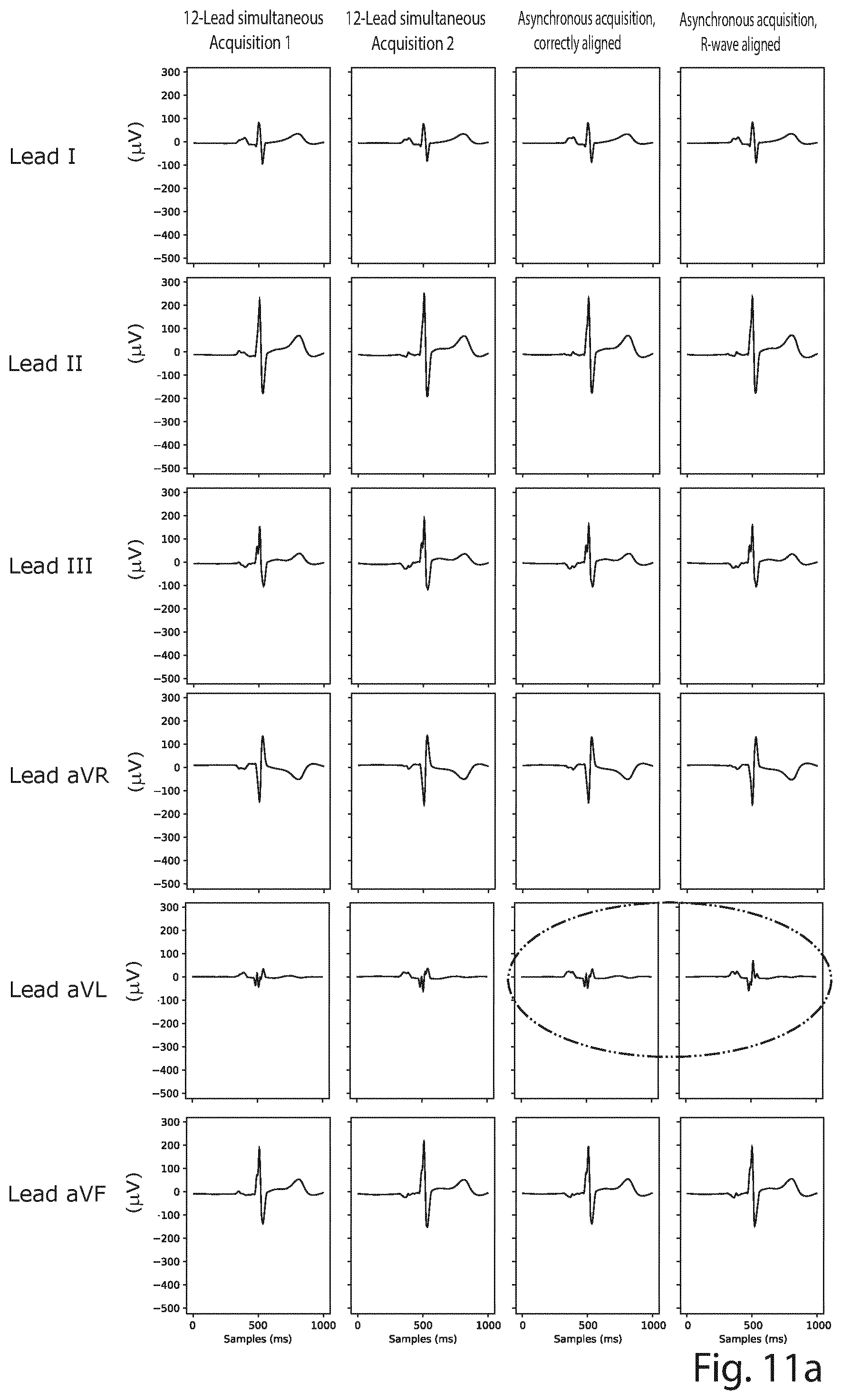 Patent US12426822 Figure 9 – Method and a system for producing a standard 12-lead ECG