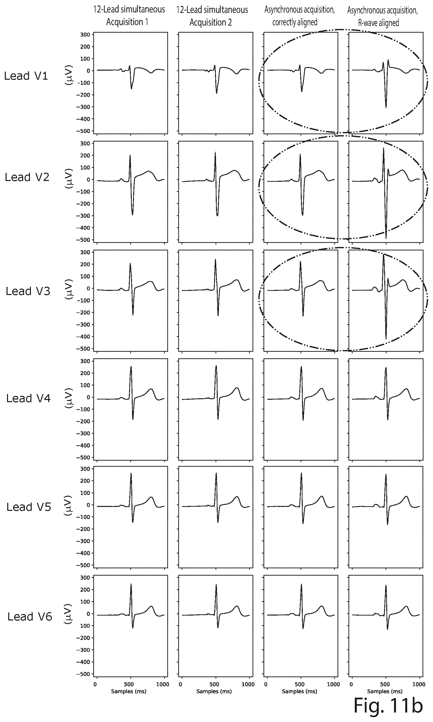 Patent US12426822 Figure 10 – Method and a system for producing a standard 12-lead ECG