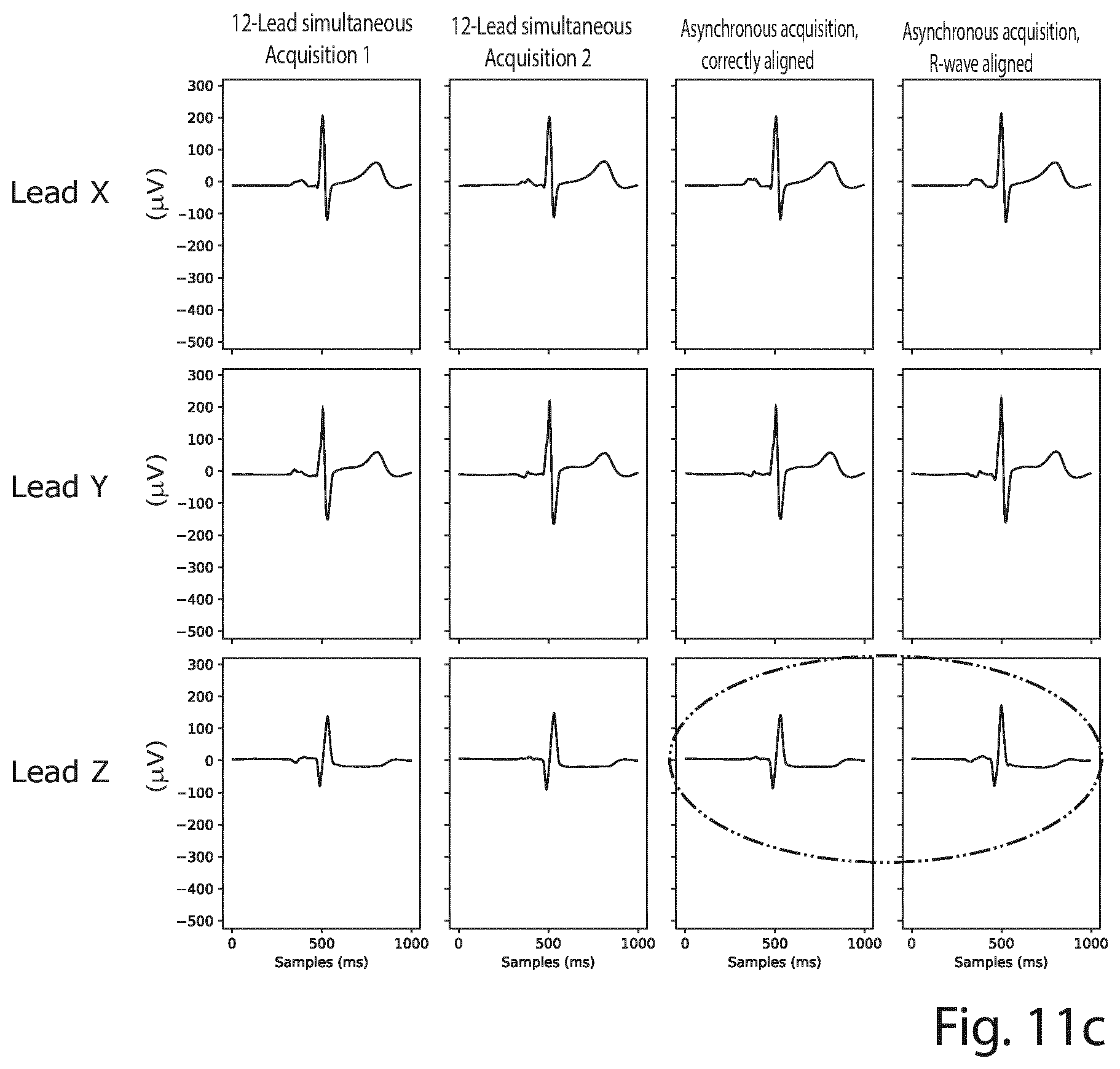 Patent US12426822 Figure 11 – Method and a system for producing a standard 12-lead ECG