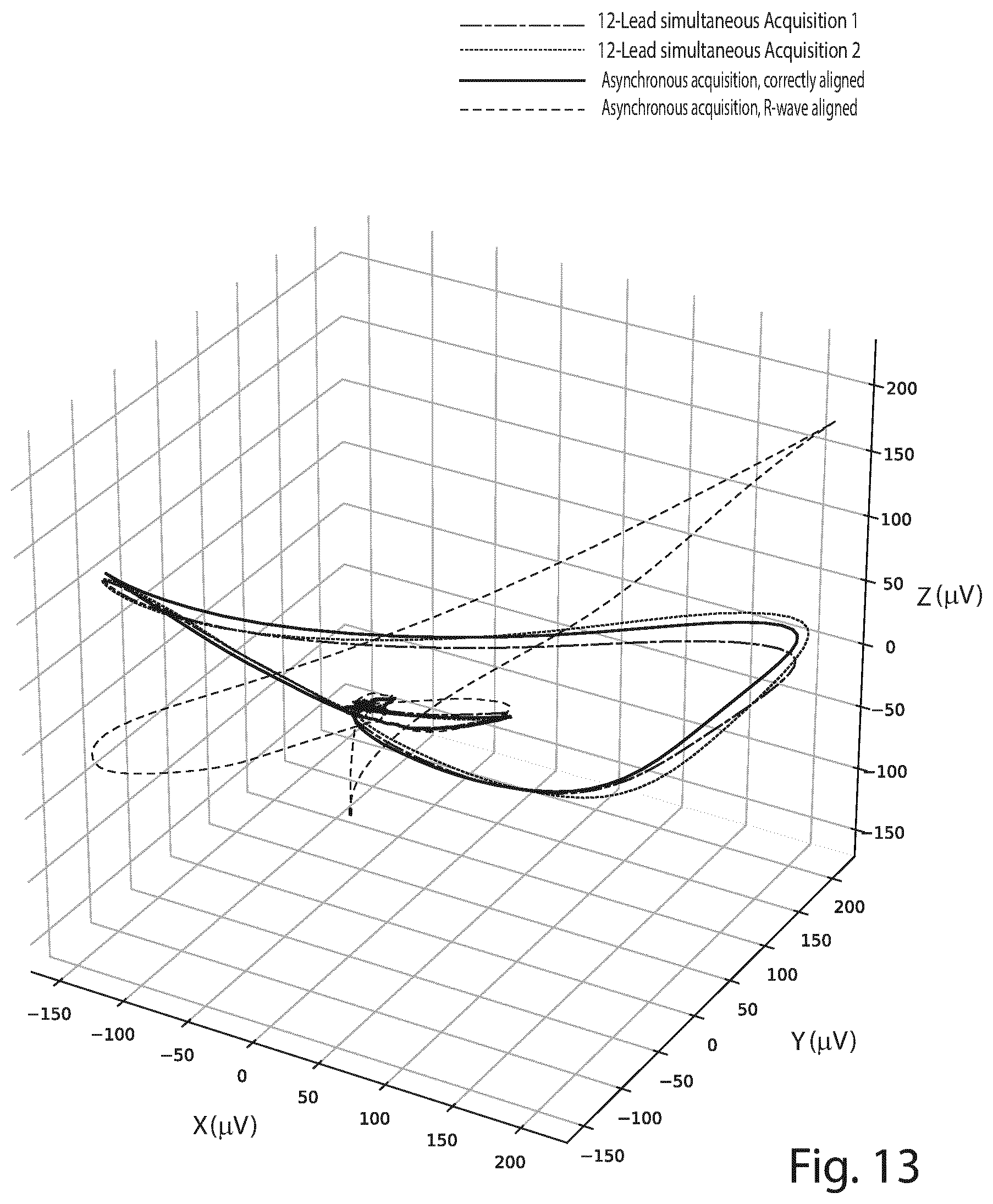 Patent US12426822 Figure 13 – Method and a system for producing a standard 12-lead ECG