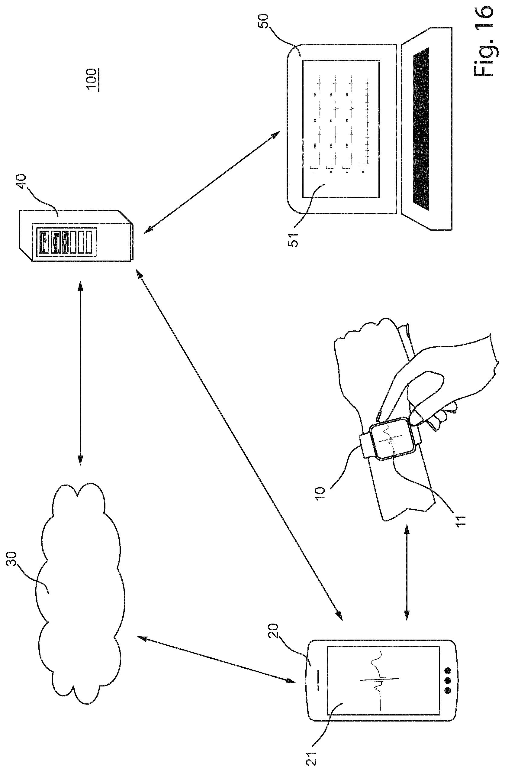 Patent US12426822 Figure 16 – Method and a system for producing a standard 12-lead ECG
