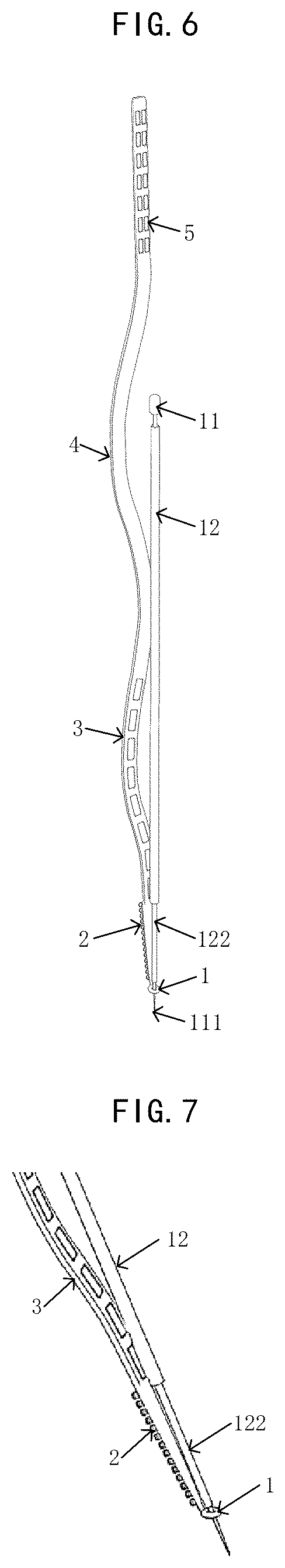 Patent US12426823 Figure 4 – Implantable flexible electrode, device, and kit