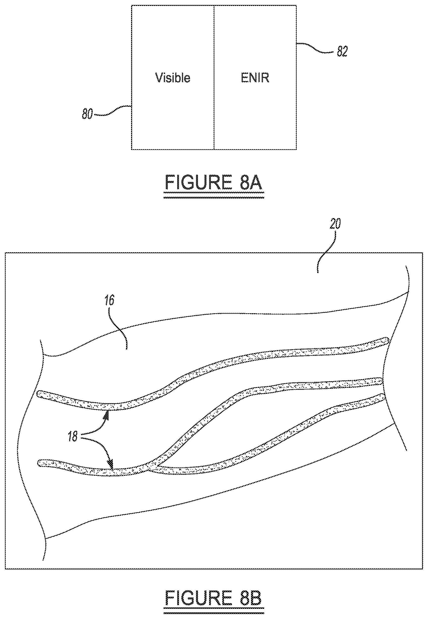 Patent US12426833 Figure 6 – Imaging system and method for enhanced visualization of near surface vascular structures