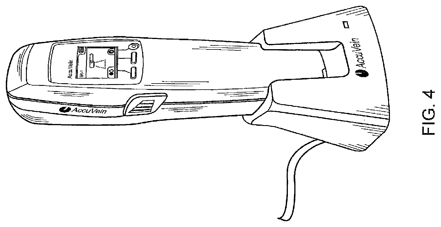 Patent US12426835 Figure 4 – Vein scanner with housing configured for single-handed lifting and use