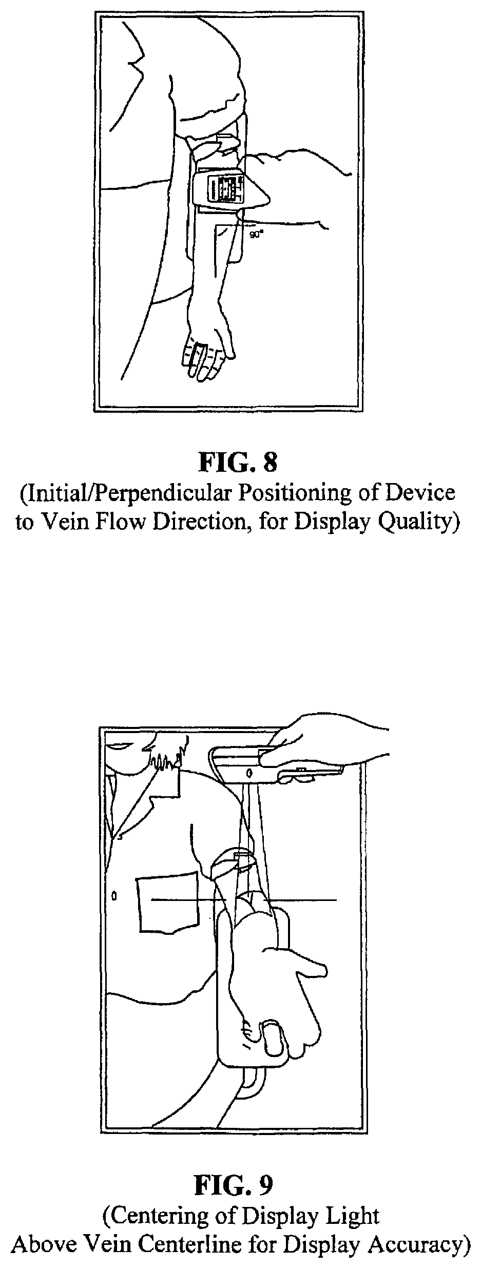 Patent US12426835 Figure 8 – Vein scanner with housing configured for single-handed lifting and use