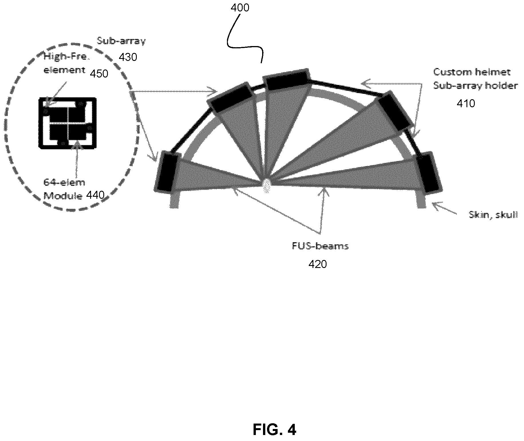 Patent US12426836 Figure 4 – Patient-specific headset for diagnostic and therapeutic transcranial procedures