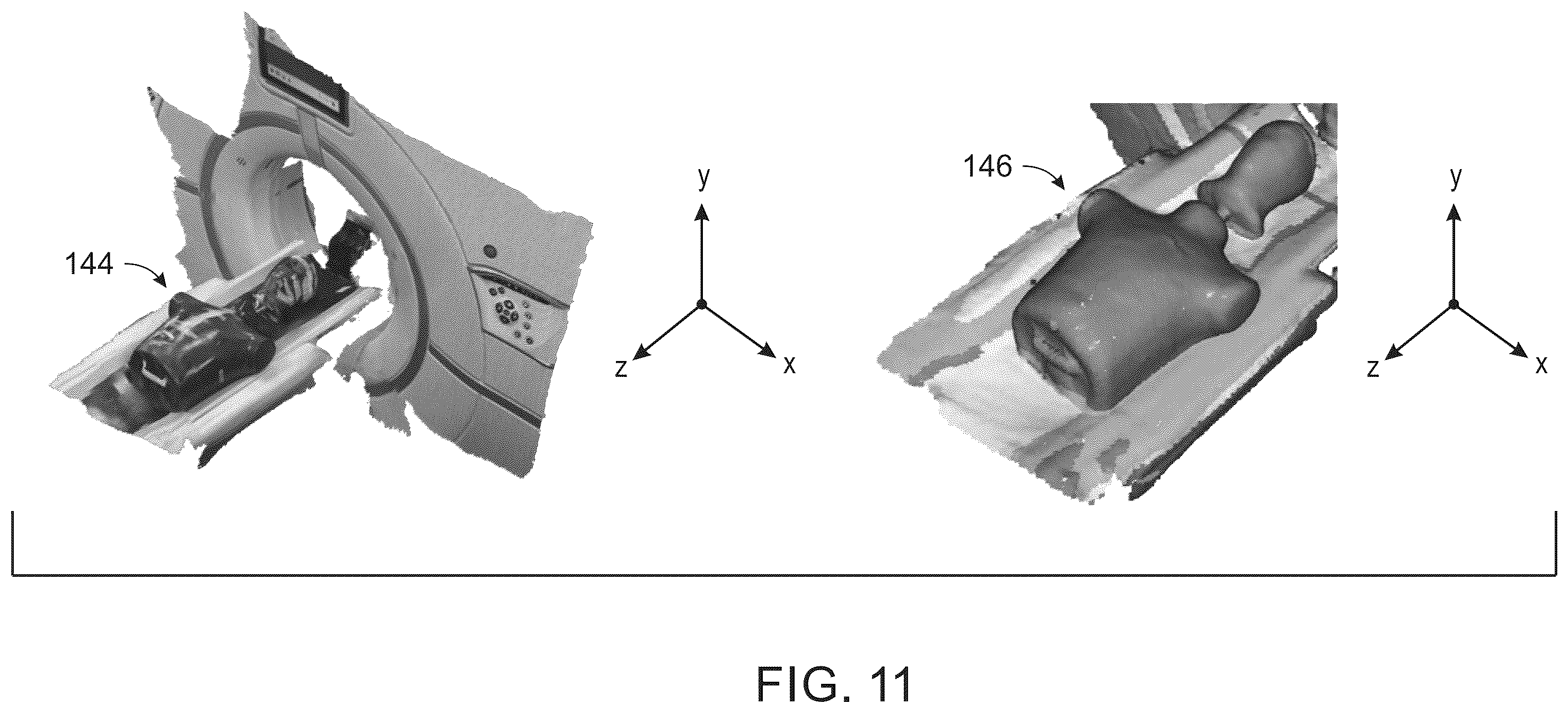 Patent US12426841 Figure 10 – System and method for a LIDAR guided patient positioning apparatus for a computed tomography system