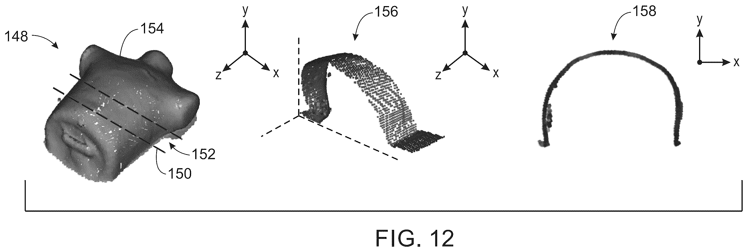 Patent US12426841 Figure 11 – System and method for a LIDAR guided patient positioning apparatus for a computed tomography system