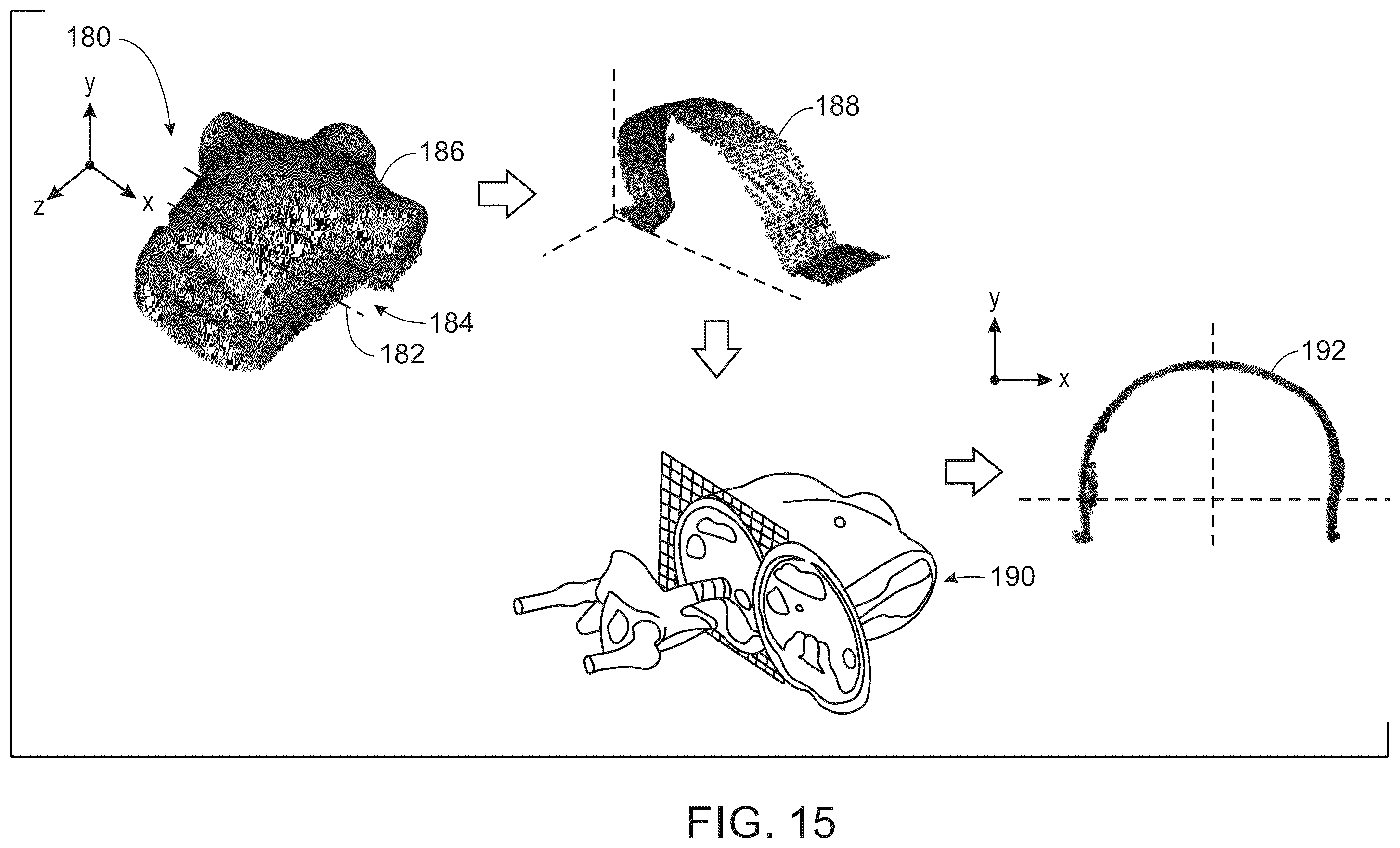Patent US12426841 Figure 14 – System and method for a LIDAR guided patient positioning apparatus for a computed tomography system