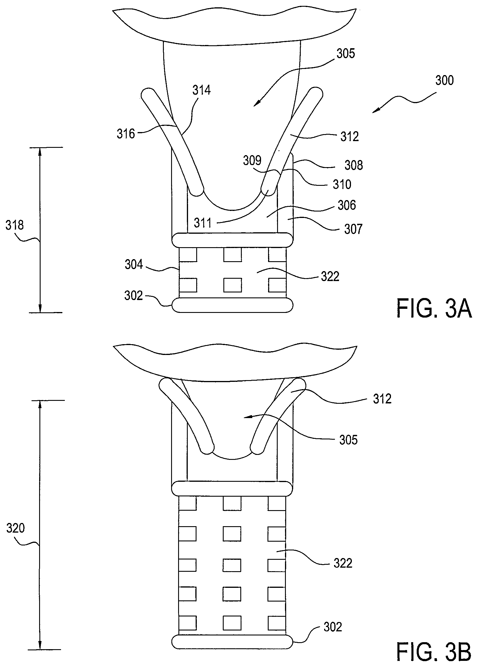 Patent US12426844 Figure 3 – Fixturing and support for medical imaging