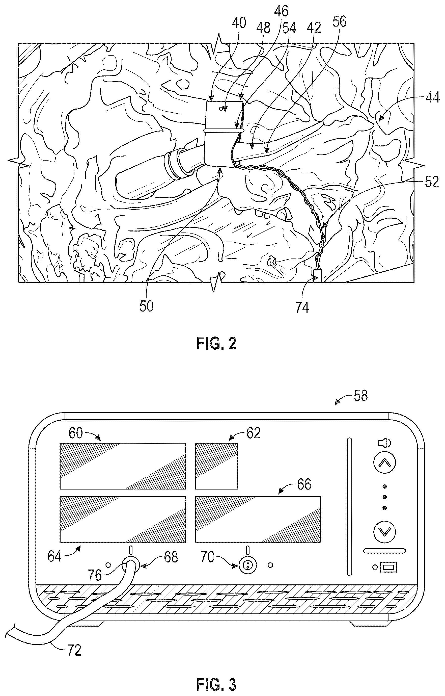 Patent US12426848 Figure 2 – Blood flow monitors and methods of monitoring characteristics of tissue