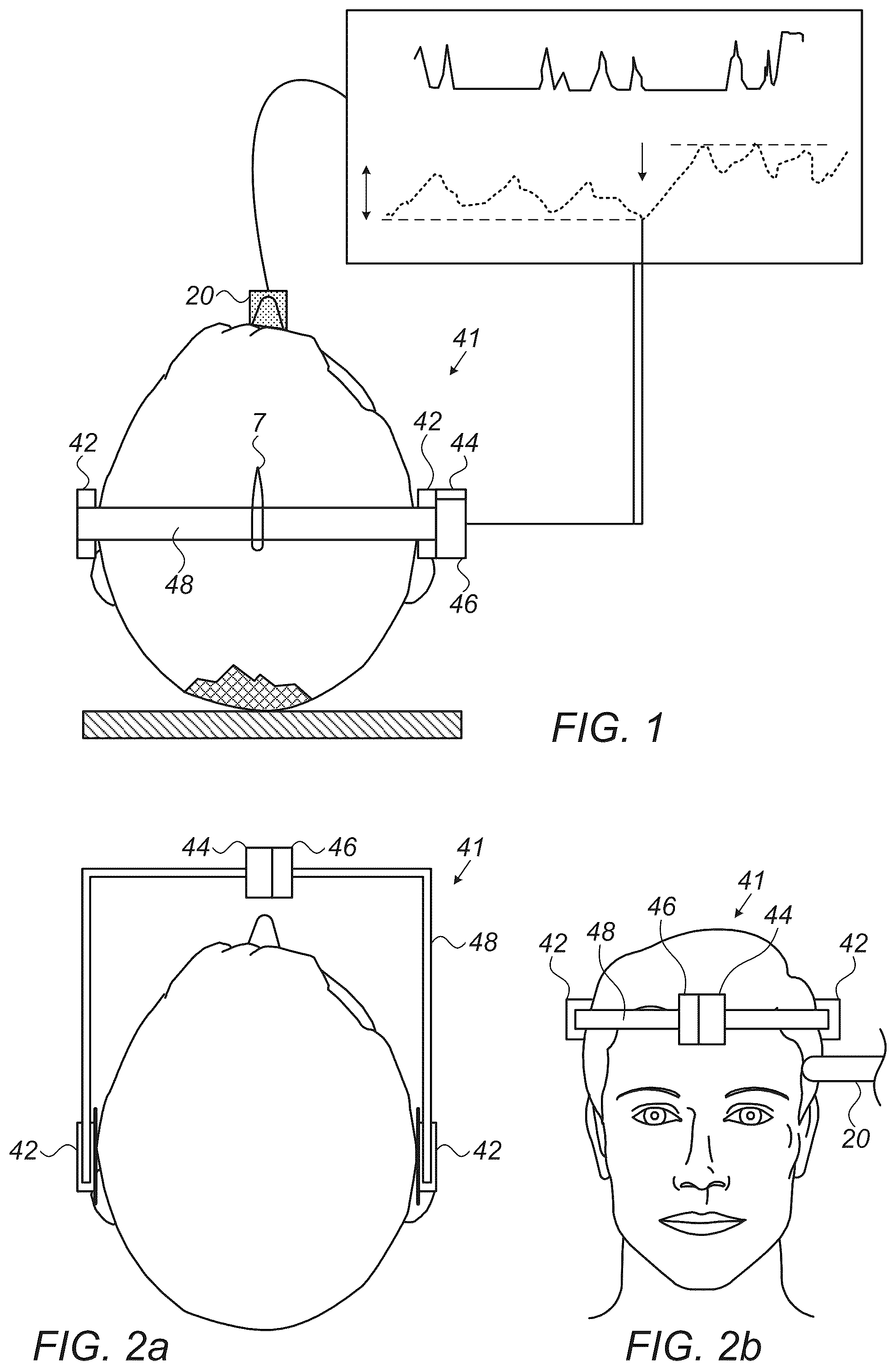 Patent US12426849 Figure 1 – Method and apparatus for noninvasive absolute (mean) intracranial pressure (A-ICP) measurement and/or monitoring
