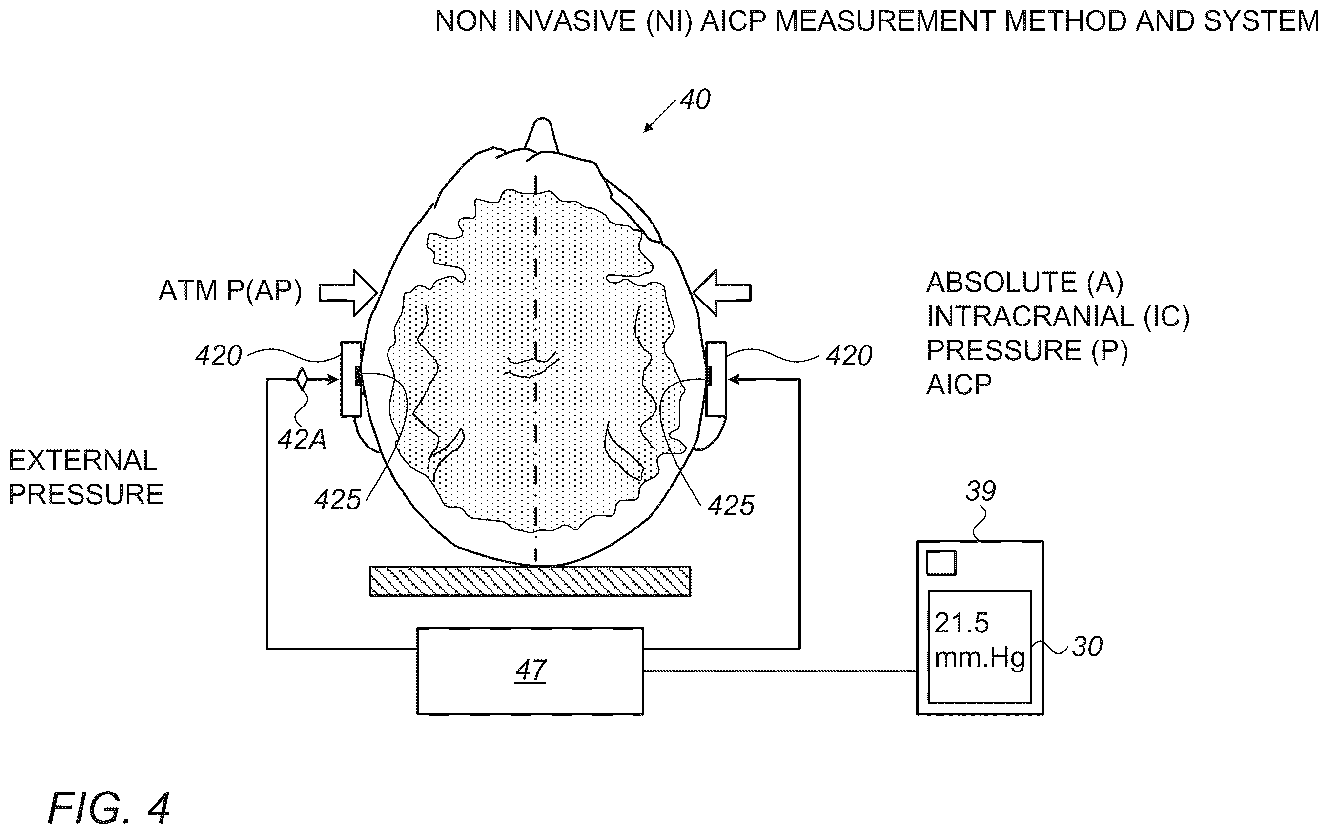 Patent US12426849 Figure 3 – Method and apparatus for noninvasive absolute (mean) intracranial pressure (A-ICP) measurement and/or monitoring